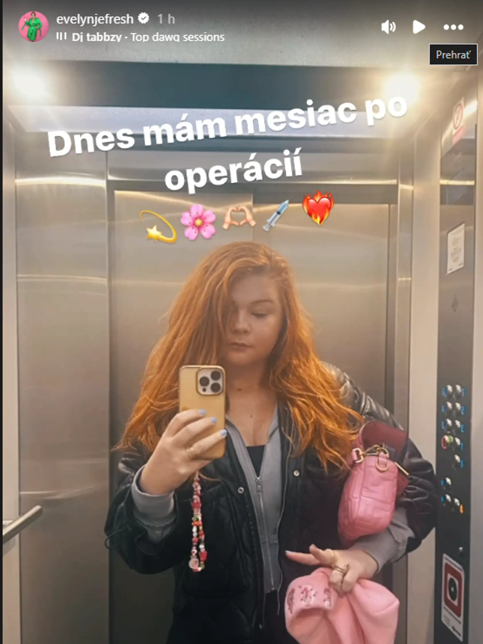 Evelyn robí rozprávanie problémy aj mesiac po operácii čeľuste.