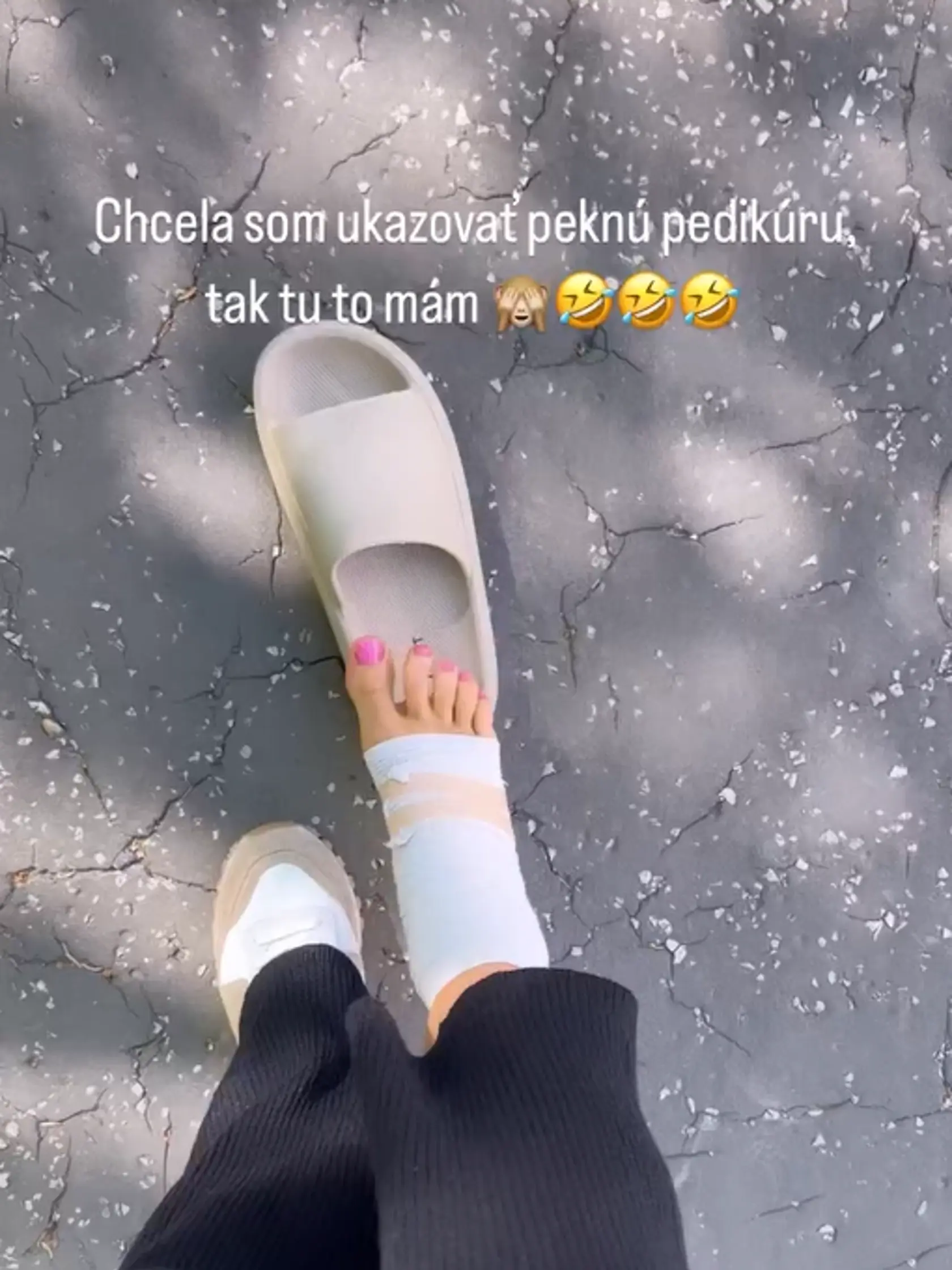 Noha jej opuchla a podľa jej slov teraz vyzerá ako "noha maca".