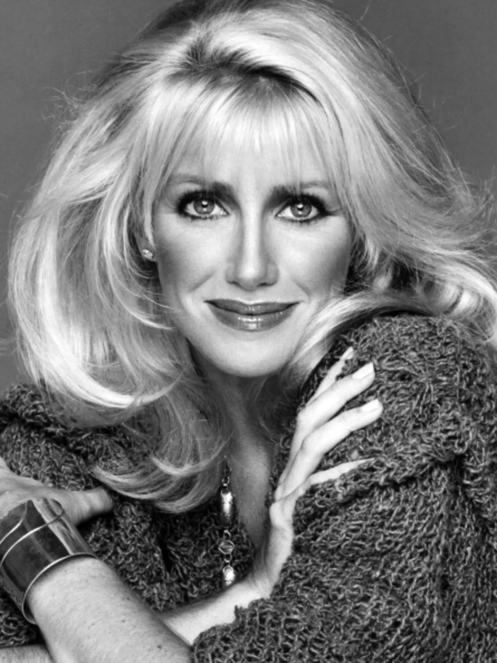 Suzanne Somers pred plastickými operáciami. 