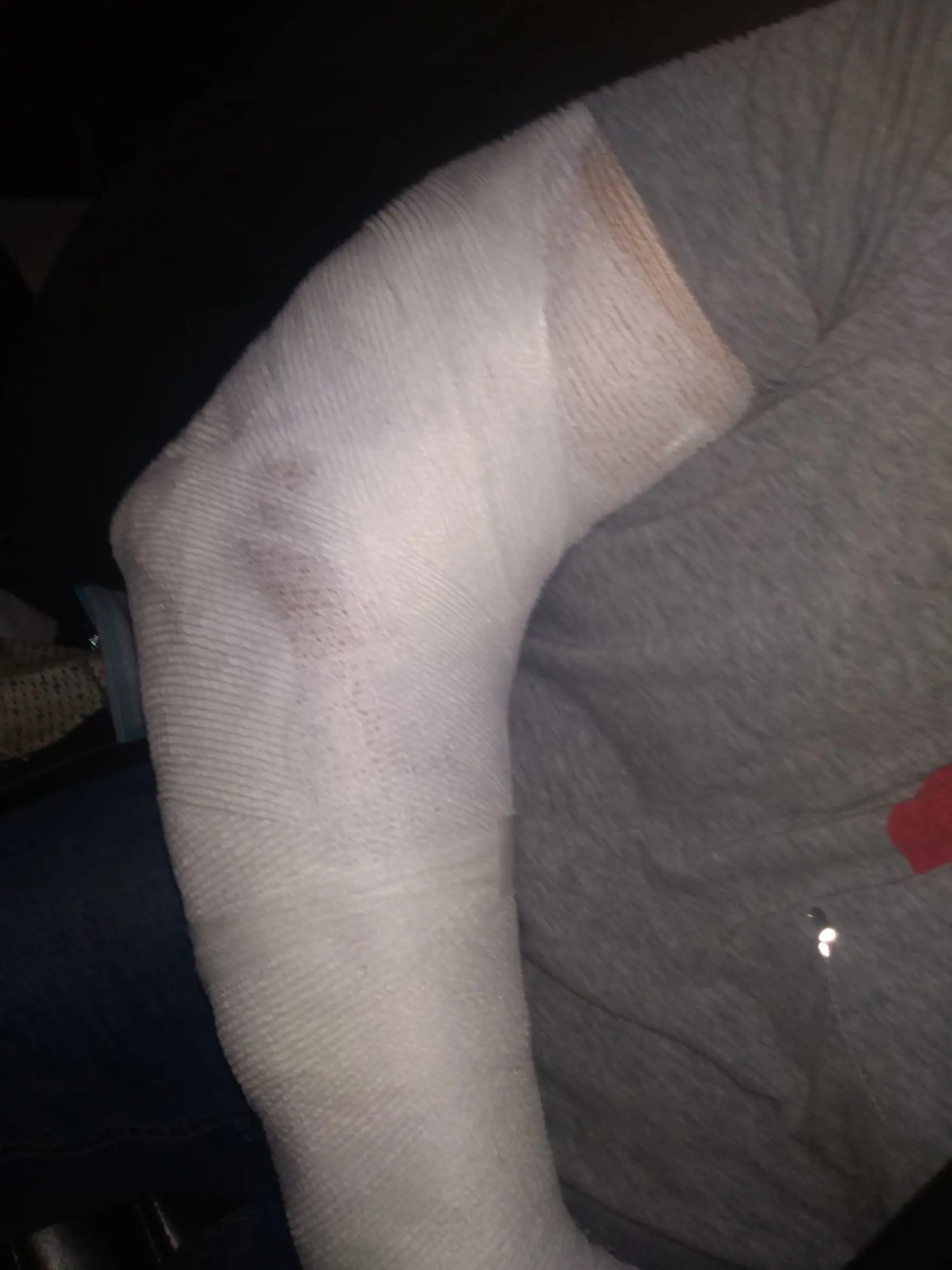 Podnikateľ má od útoku veľké bolesti pravej ruky.