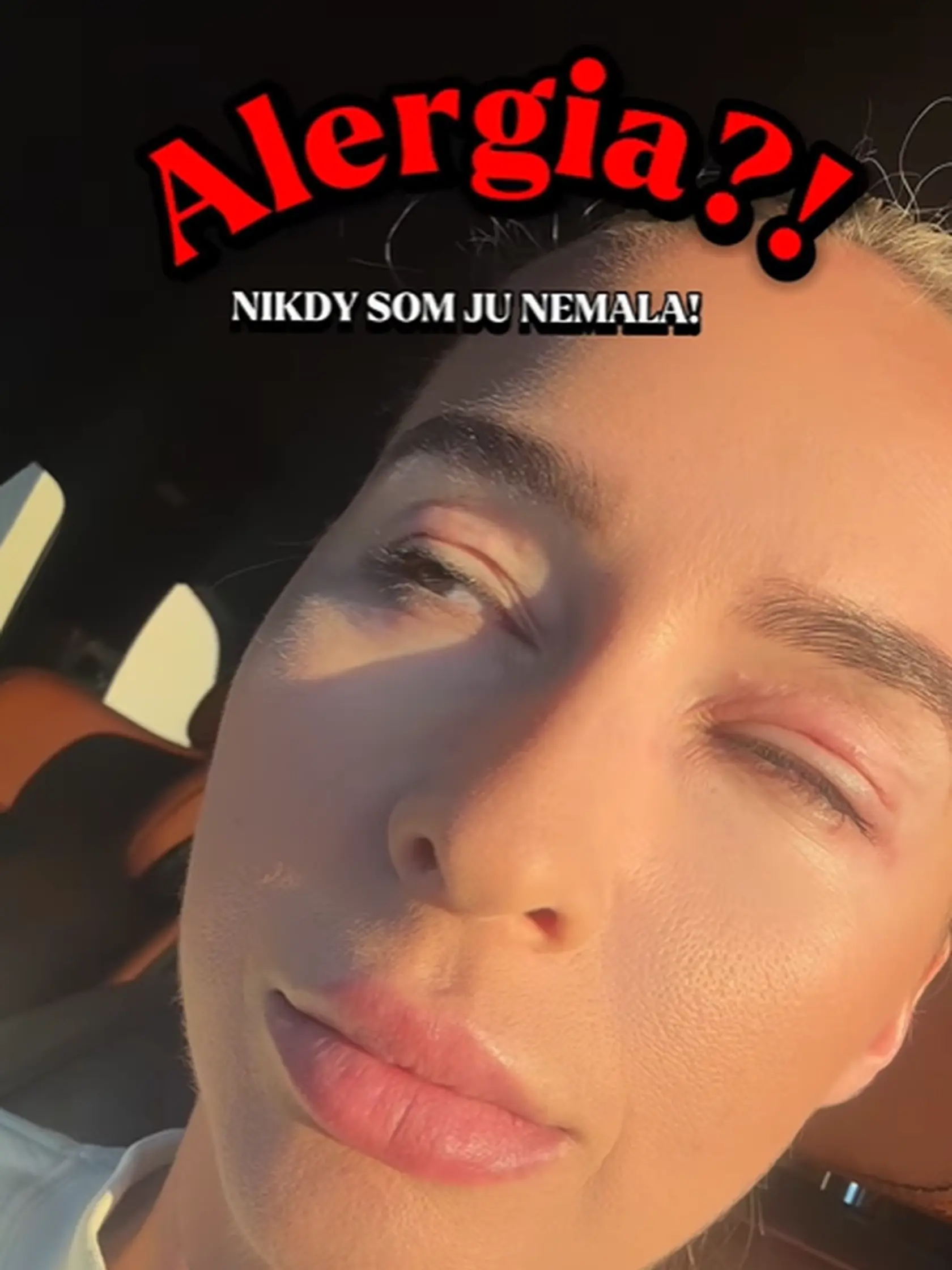 Lucia Mokráňová zverejnila záber, ktorý vystrašil fanúšikov. Takto vyzerala?