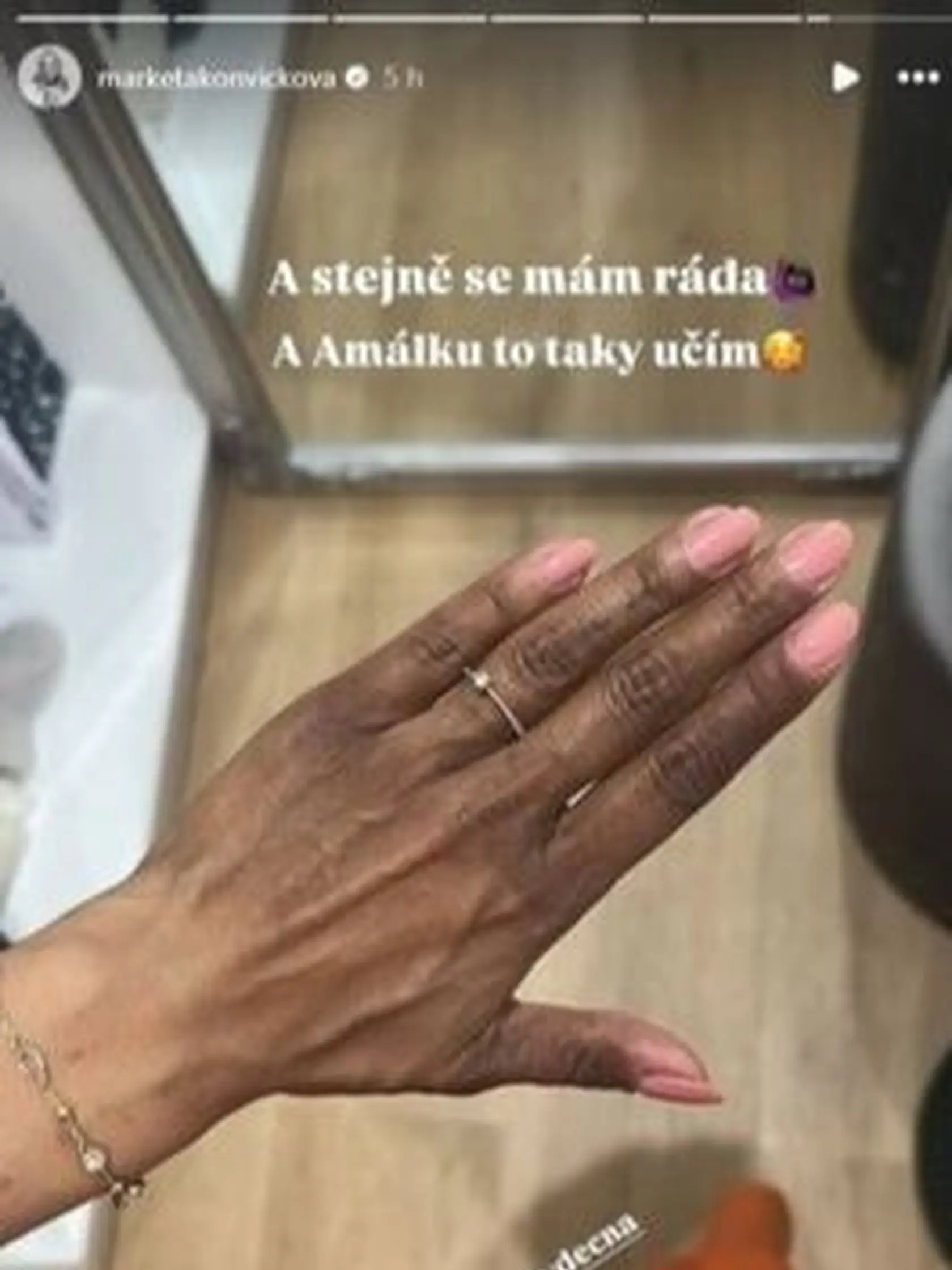 Na ruke má tmavé škvrny.