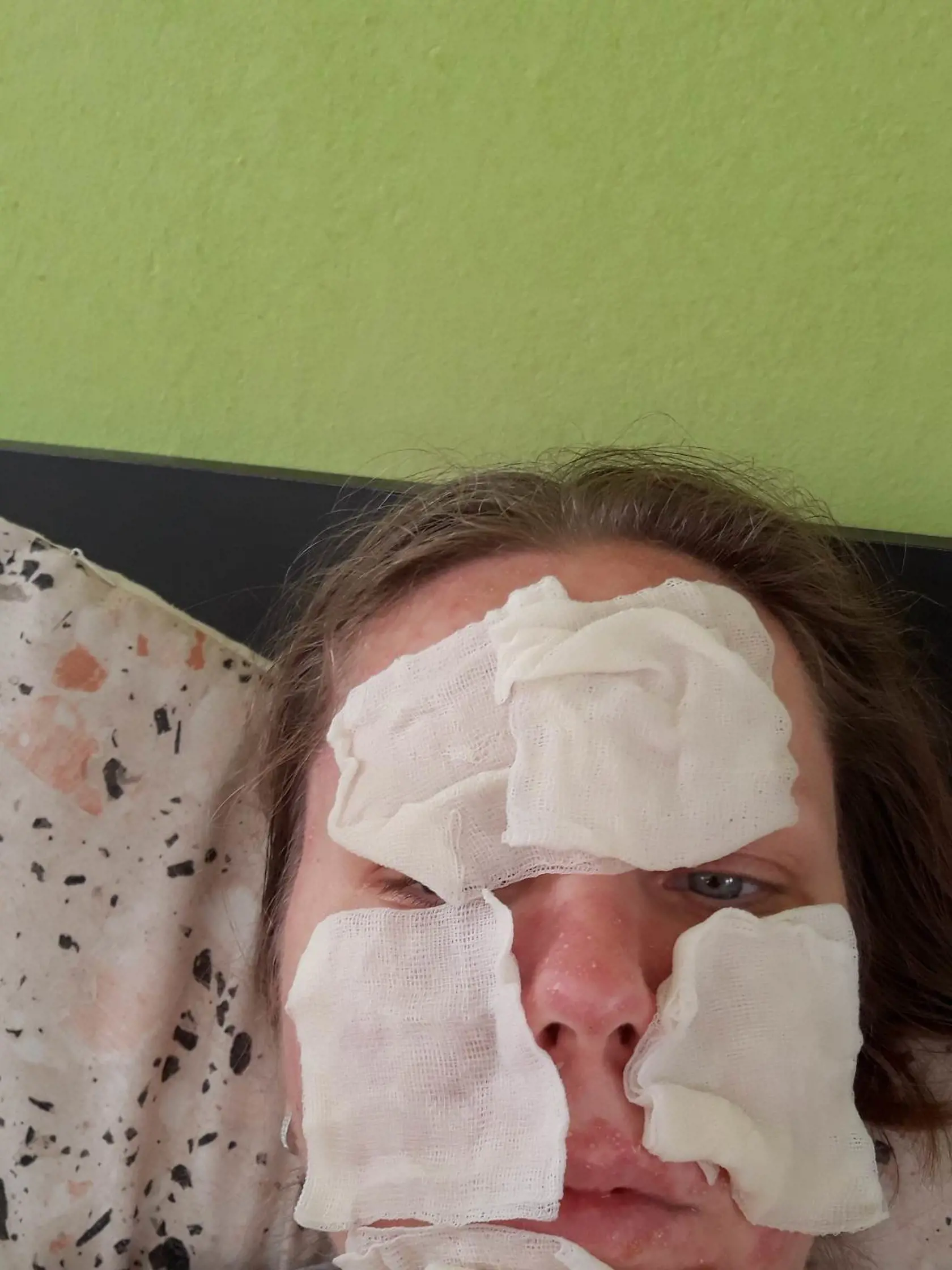 Našla ďalšiu možnosť liečby v Čechách, kde jej určili liek priamo z analýzy DNA nádoru, ktorý by mal pomôcť. Aj tu sa však začali prejavovať vedľajšie účinky. Očakávalo sa, že sa jej objavia vyrážky a tak aj bolo.