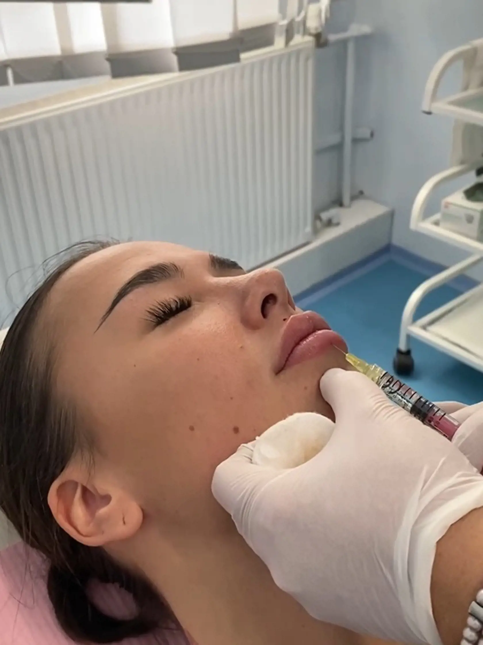 Marcela si nechala opäť zväčšiť pery, na zákrok ju sprevádzal Tomáš.
