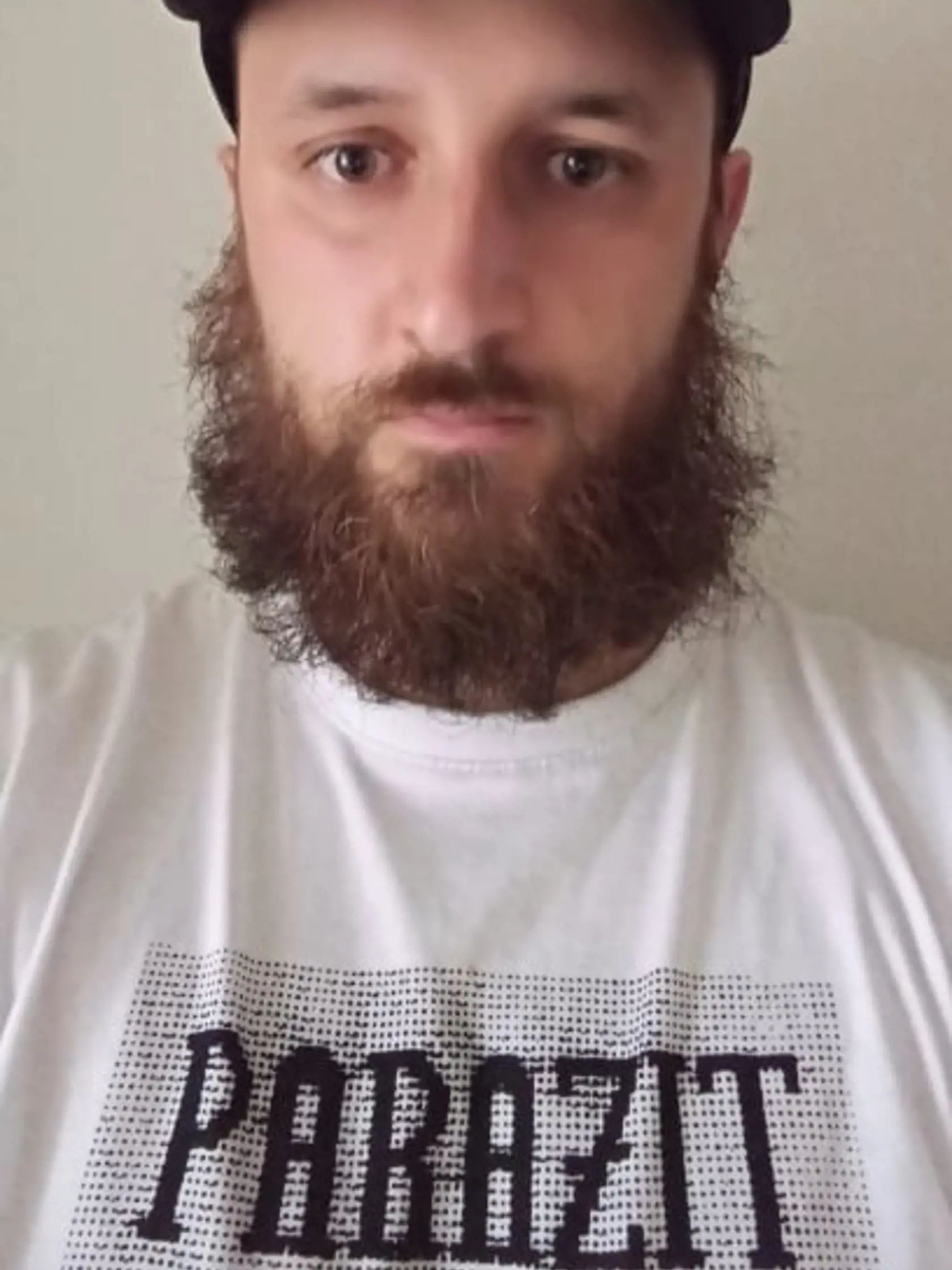 Adam (33) z Brezna: Keďže som momentálne v pocovidovom období, túto dilemu našťastie nemusím riešiť. Do očkovania sa aj tak zatiaľ nehrniem. Prednosť majú starší. Keď však príde rad aj na mňa a bude možnosť výberu vakcíny, rád Sputnik prenechám občanom, ktoré majú pozitívnejší vzťah k Ruskej federácii. Určite je ich na Slovensku dosť.