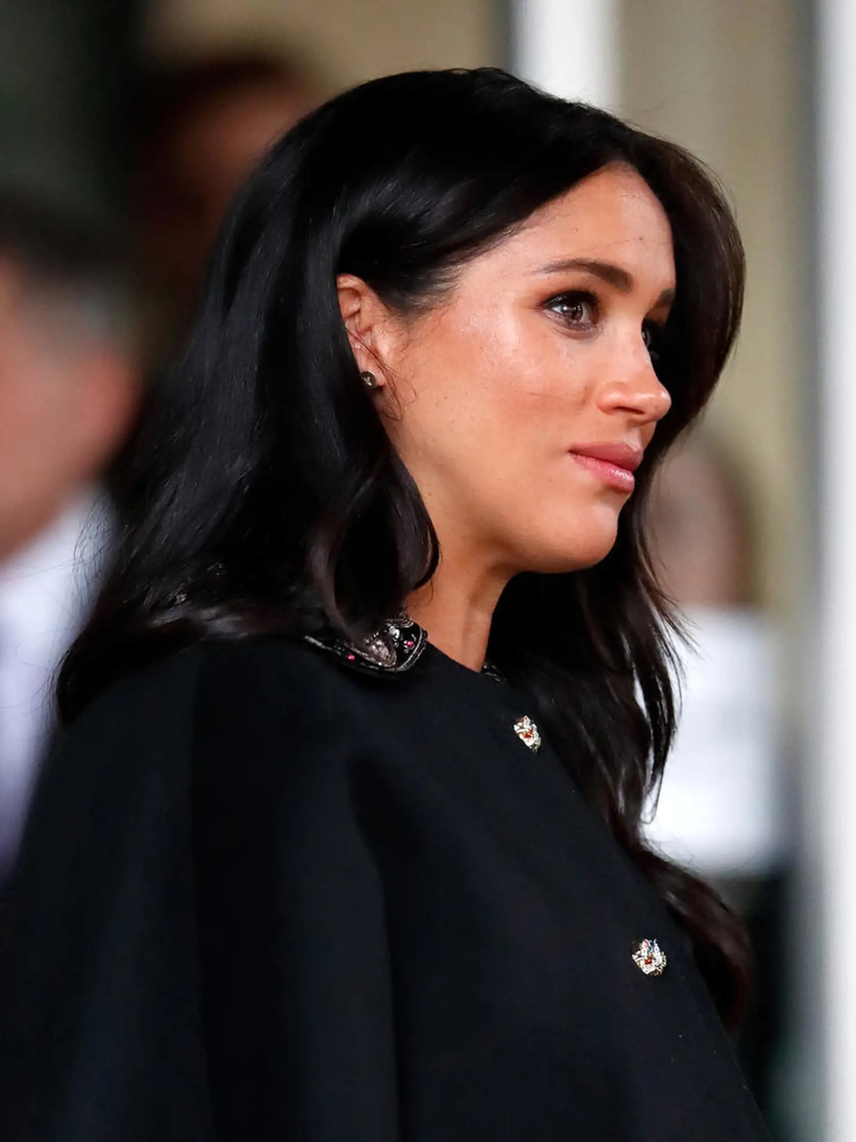 Meghan Markle je jednou z najobdivovanejších žien sveta, avšak čím ďalej, tým viac sa šepká o tom, že má plastiku nosa.