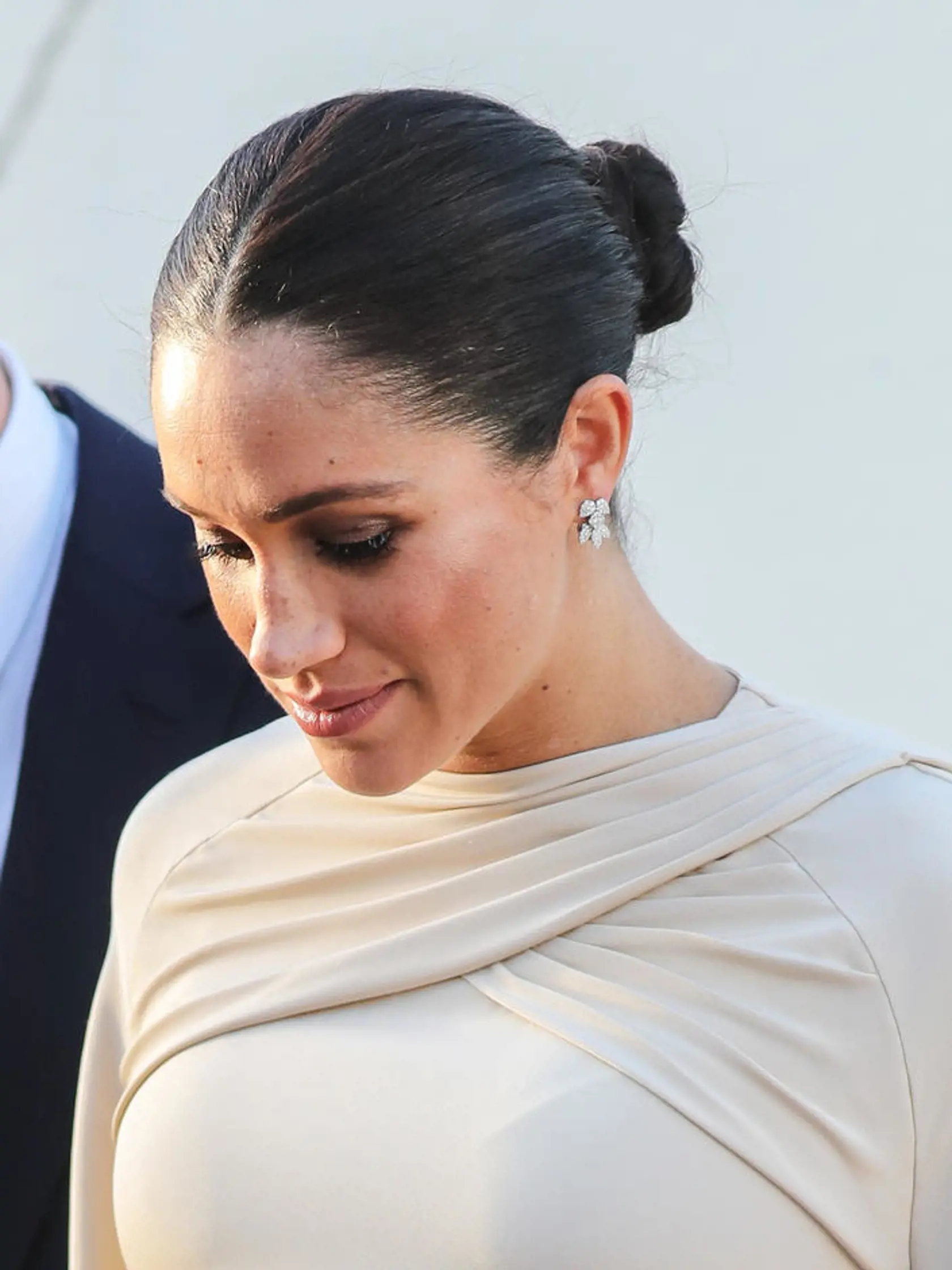 Odborníci sa zhodli, že nos Meghan Markle je urobený tak precízne a jemne, že tvár naďalej pôsobí absolútne prirodzene.
