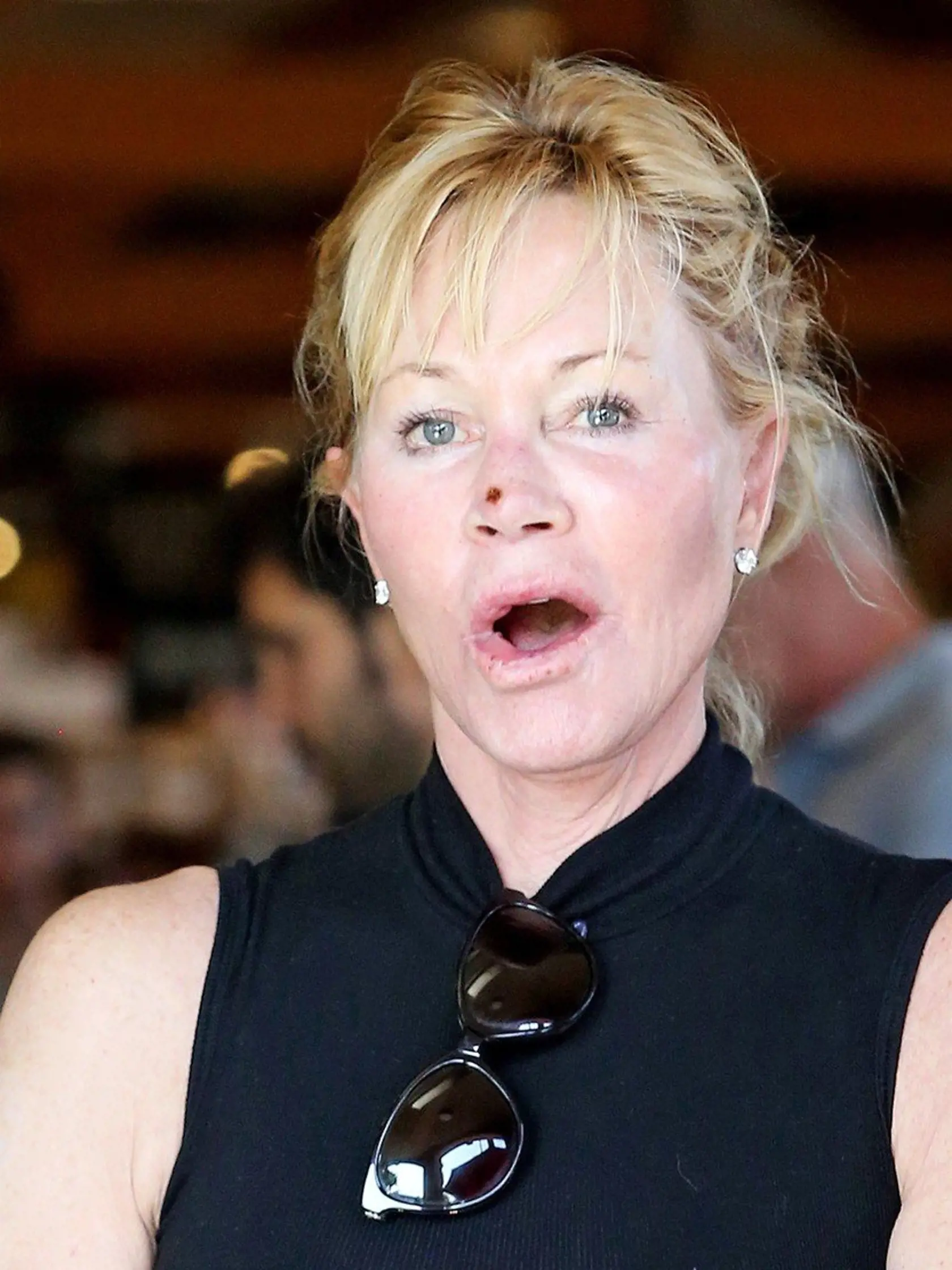 West Hollywood, CA  - *EXCLUSIVE* Melanie Griffith gets camera shy as she steps out for groceries at Bristol Farms with messy hair and no make up revealing a scab on her nose.    Pictured: Melanie Griffith    BACKGRID USA 8 SEPTEMBER 2017, Image: 348809930, License: Rights-managed, Restrictions: , Model Release: no, Credit line: Profimedia, AKM-GSI