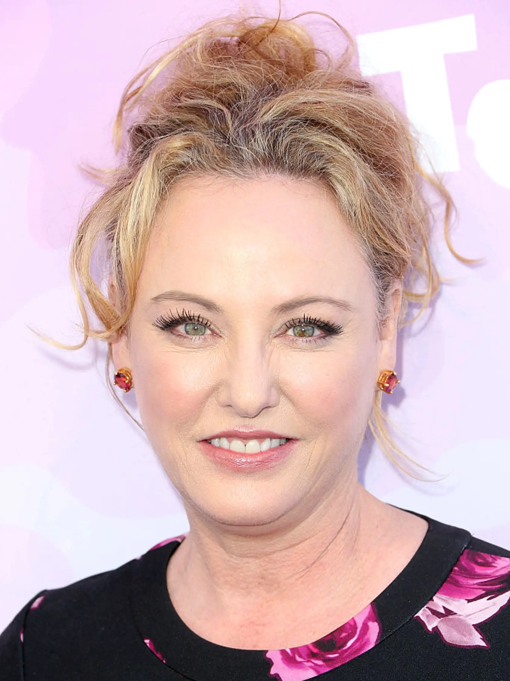 Hviezda 80. rokov Virginia Madsen nezakrýva svoju anomáliu čiernymi okuliarmi, ako to robia mnohí jej hereckí kolegovia.