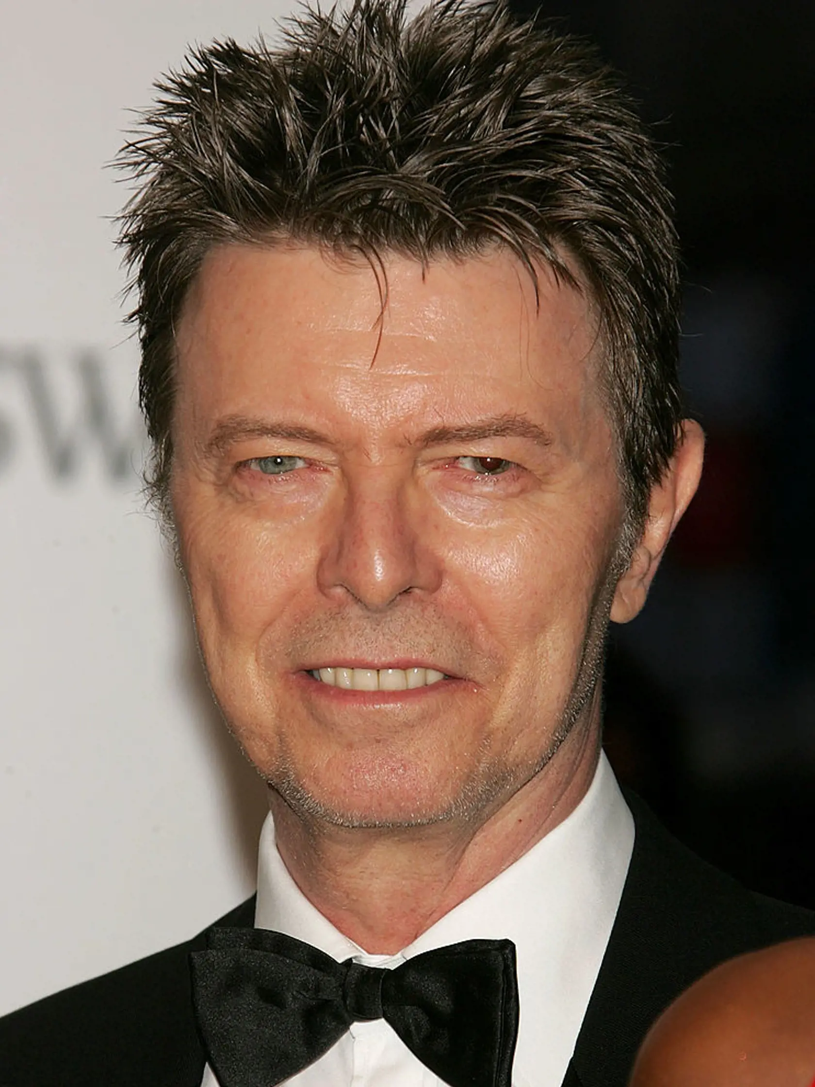 David Bowie (1947-2016) síce mal rozdielnu farbu očí, ale nie vrodenú. Stalo sa mu to po úraze a liečbe oka. 