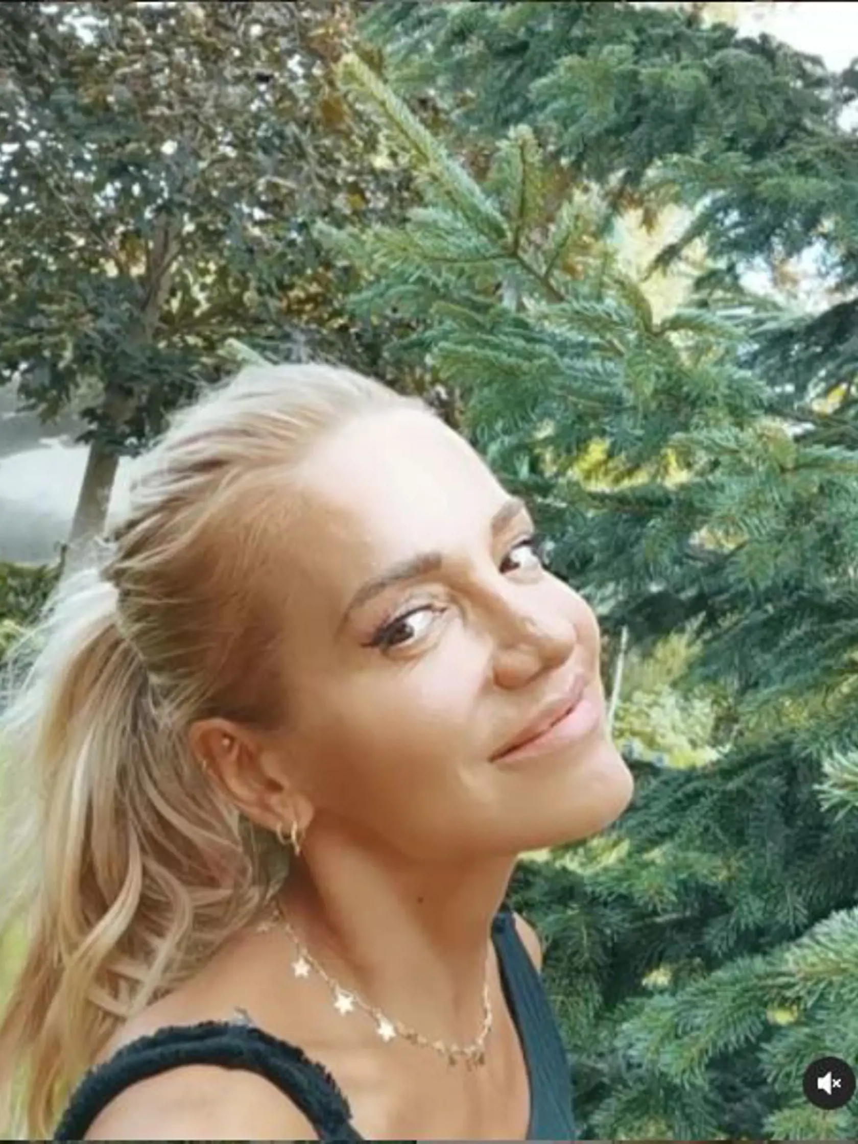Takto vyzerá Dara po poslednej operácii nosa.