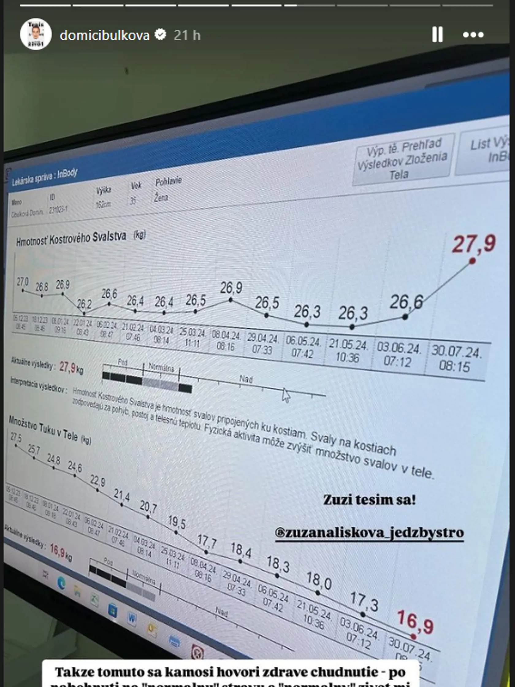 Dominika sa po domácom vážení nechala zmerať u odborníčky a výsledok ju potešil. "Tomuto sa hovorí zdravé chudnutie - po nabehnutí na "normálny" život mi stále klesá tuk v tele a makaním sa spevňujú svaly. Žiadny jojo efekt, ktorého sa niektorí "odborníci" po zverejnení pár informácií o mojej diéte "strachovali"," napísala k výsledkom.