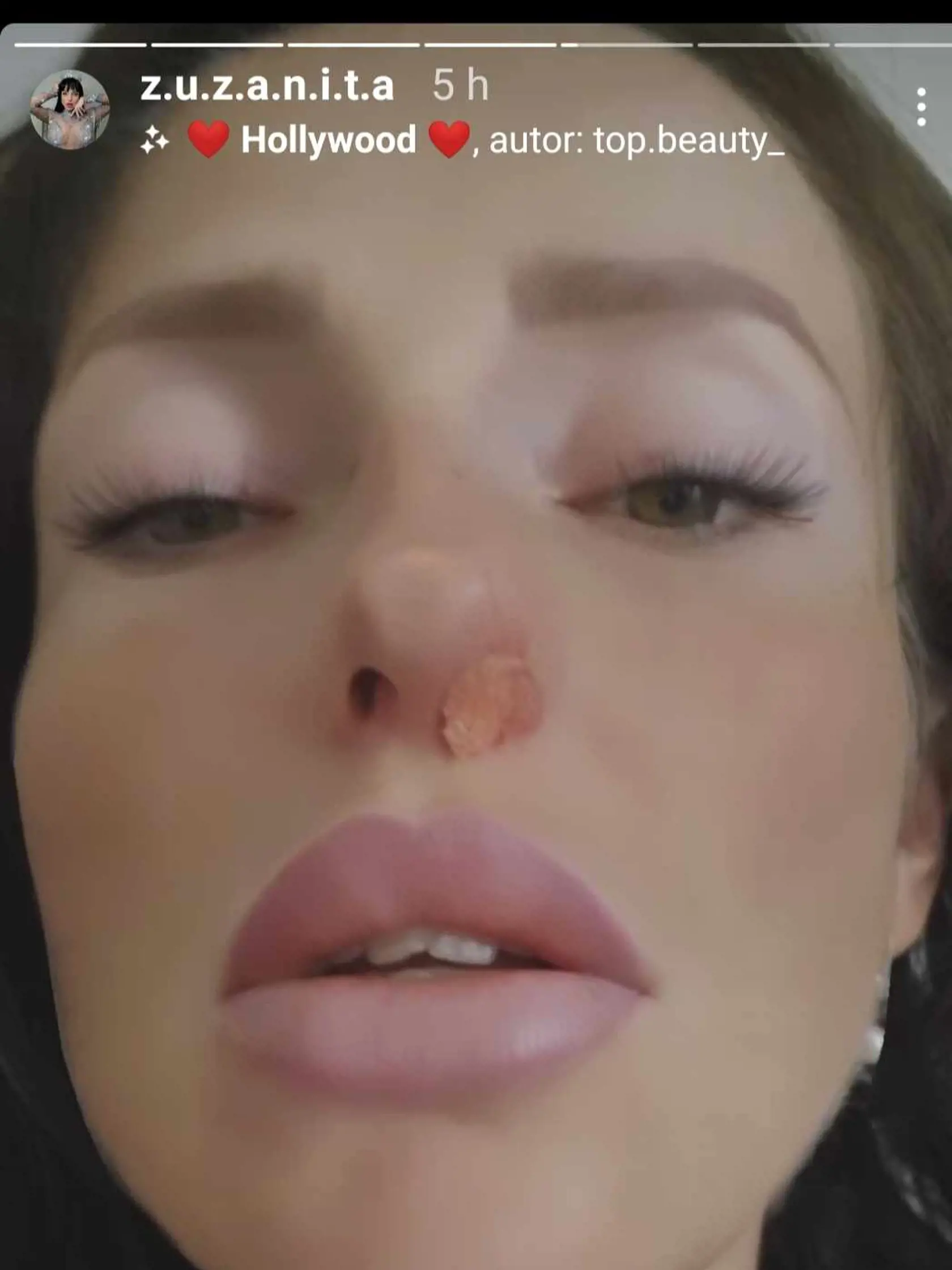 Fotky plné krvi Zuzanitu vystrašili.