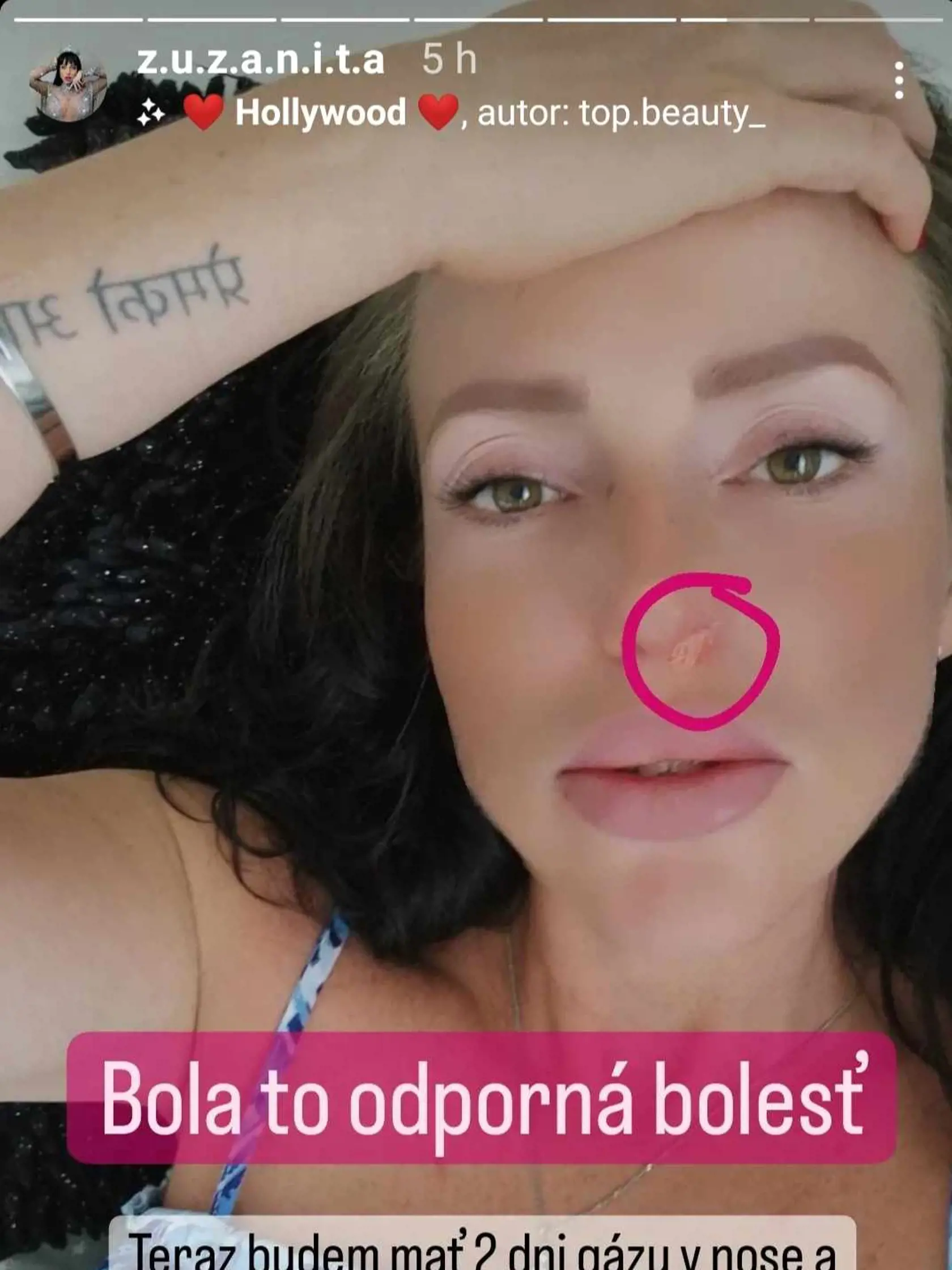 Bola to strašná bolesť.
