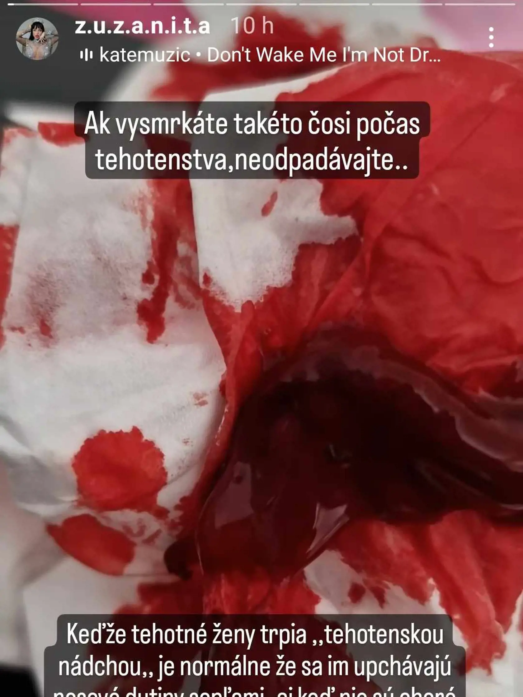 Fotky plné krvi Zuzanitu vystrašili.