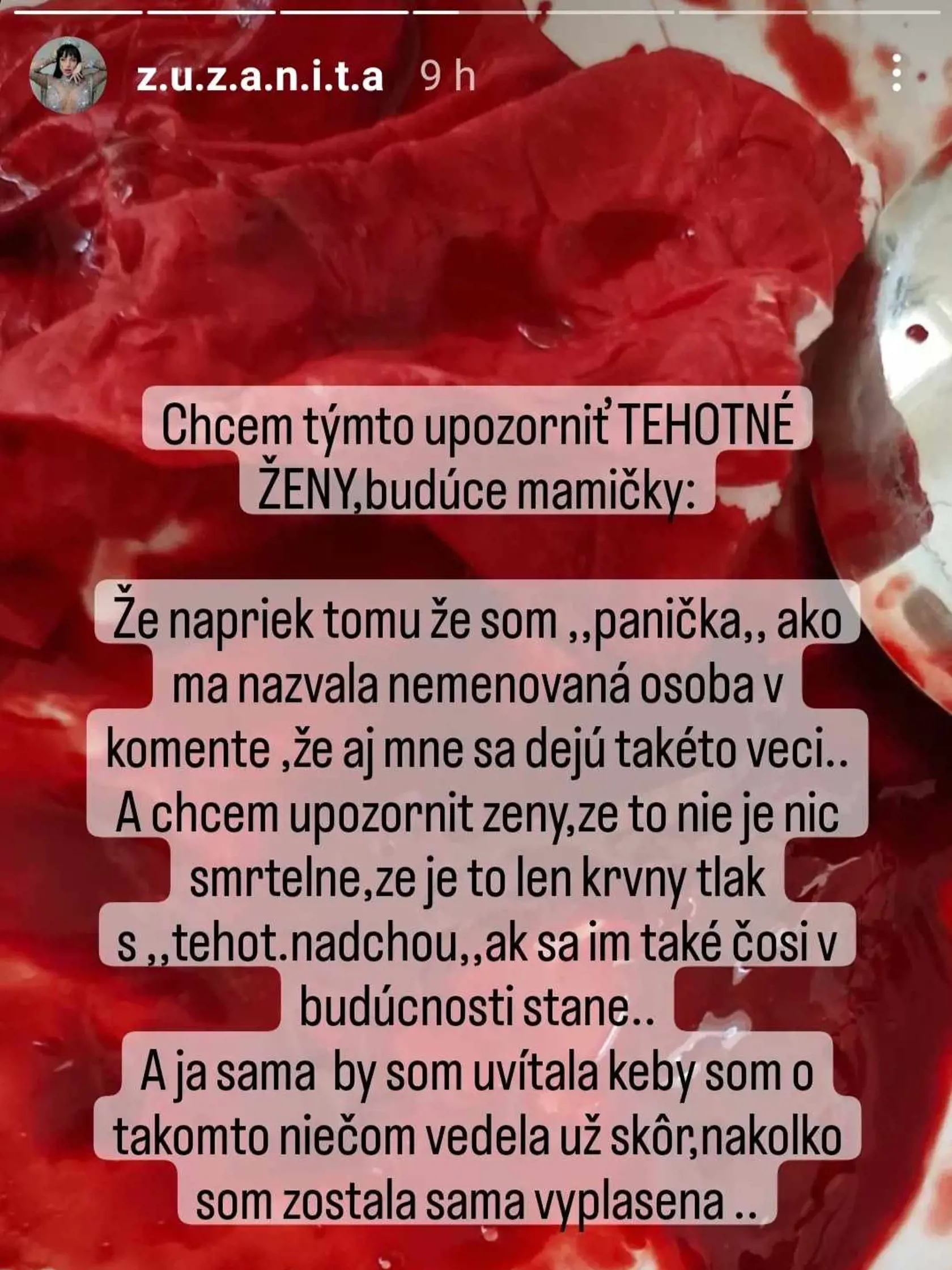 Fotky plné krvi Zuzanitu vystrašili.