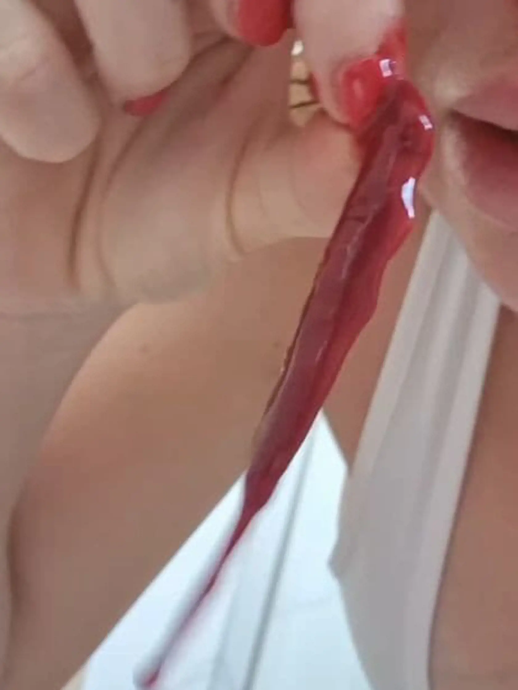 Fotky plné krvi Zuzanitu vystrašili.