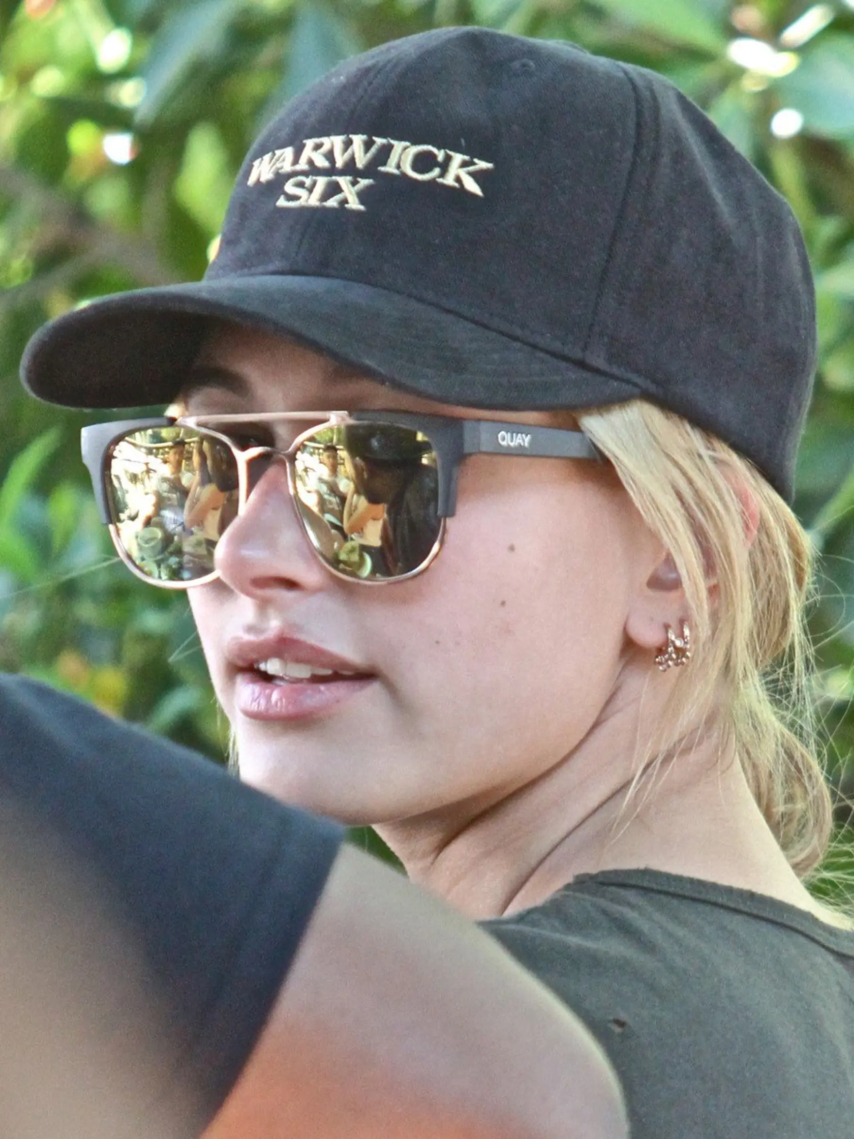 Hailey Baldwin. Dnes už manželka Justina Biebera. Na snímke má tiež herpes.