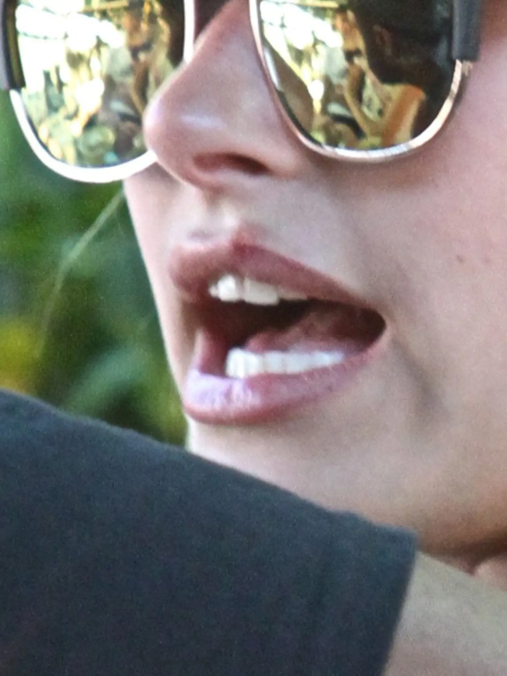 Hailey Baldwin. Dnes už manželka Justina Biebera. Na snímke má tiež herpes.
