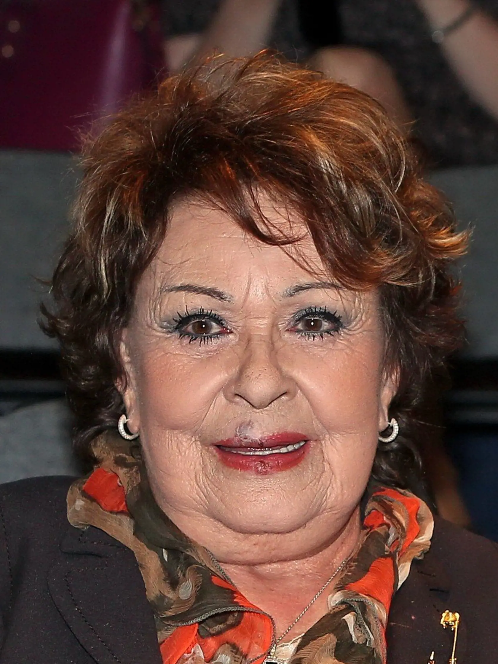 Jiřina Bohdalová musela ísť do spoločnosti aj s herpesom.