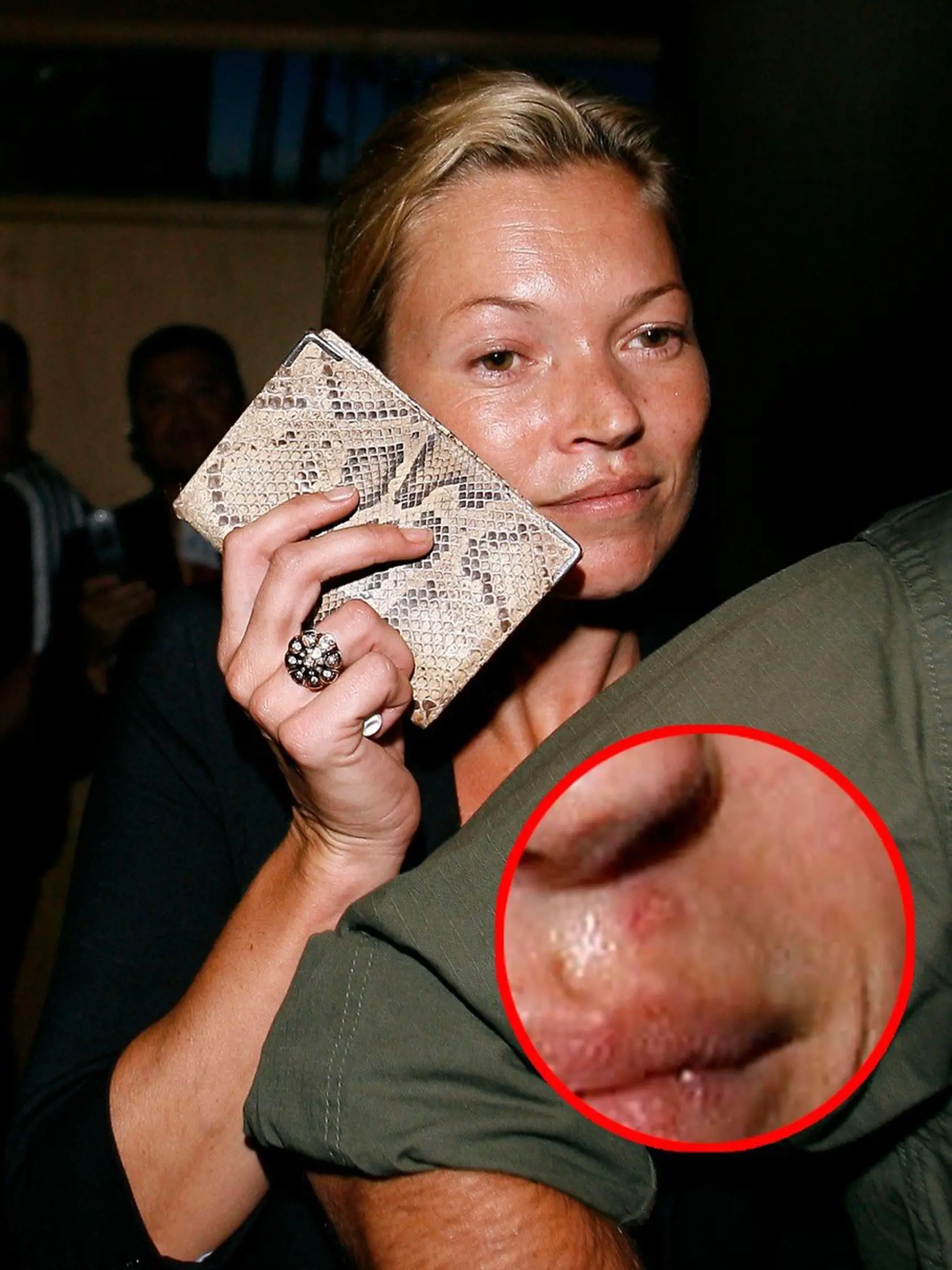 Ani kabelka jej nepomôže. Kate Moss má nad perou poriadny opar.