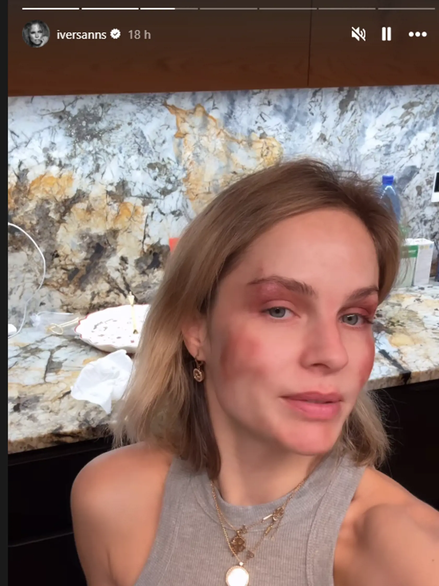 Ivana Gáborík ukázala, ako ju zmaľovala jej dcérka Bella. 
