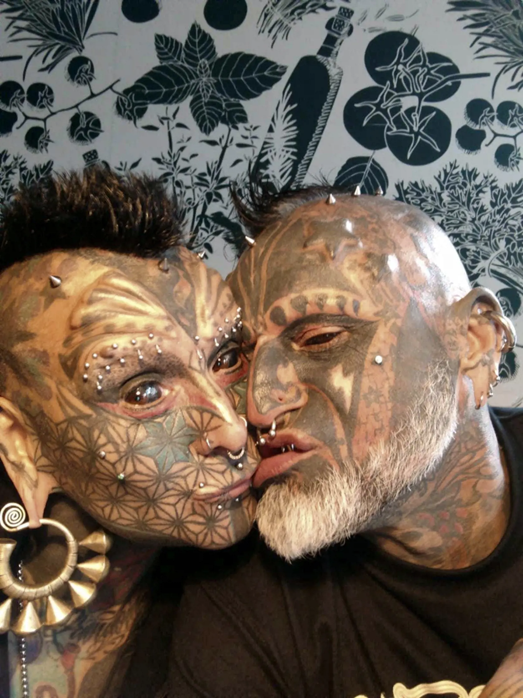 EXCLUSIVE: One half of extreme body mod couple called 'cherubs from hell' gets implants to make arms bigger