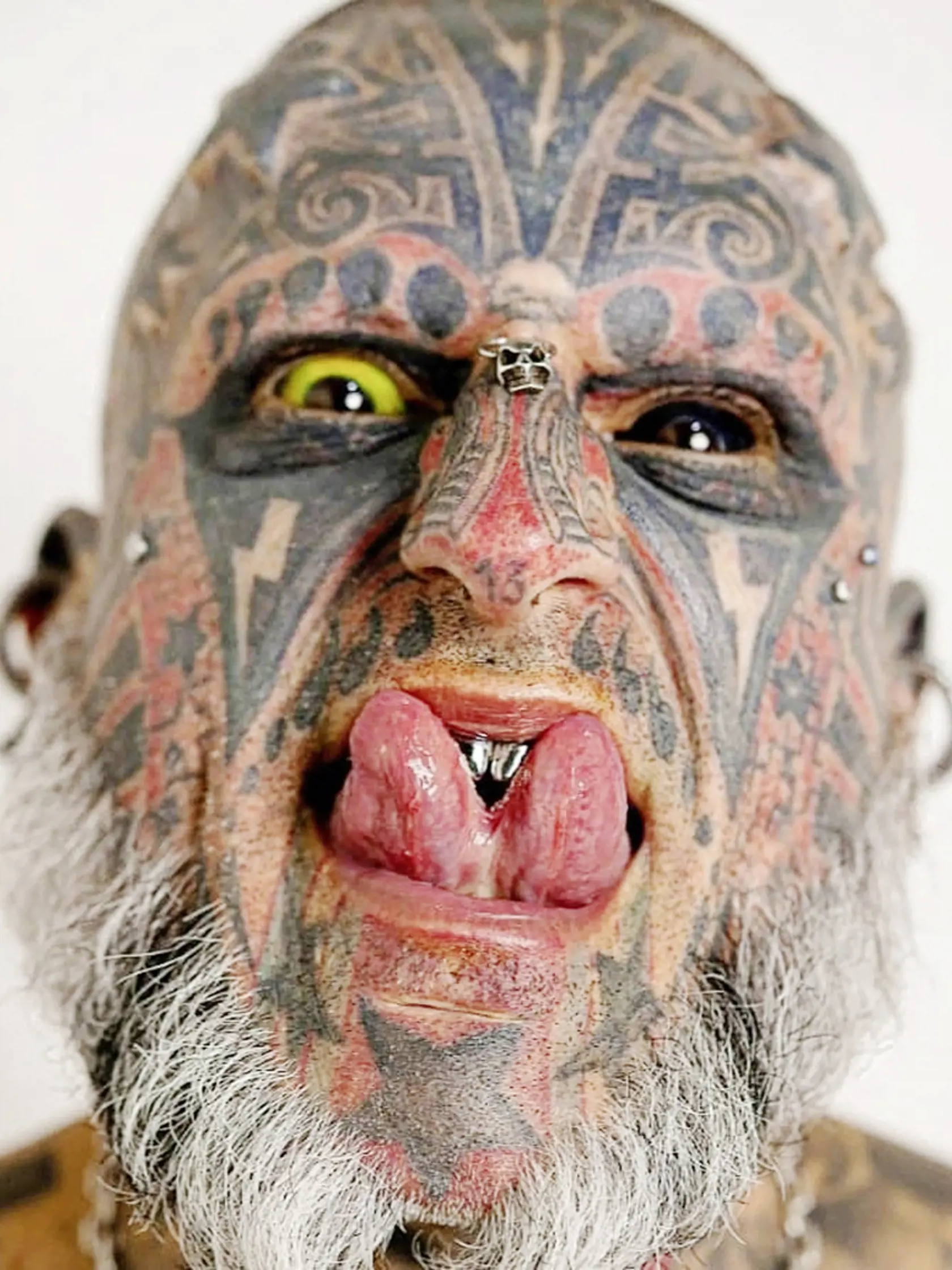 EXCLUSIVE: One half of extreme body mod couple called 'cherubs from hell' gets implants to make arms bigger