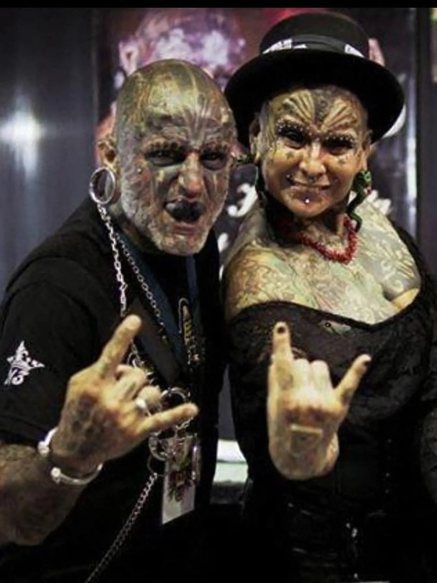 EXCLUSIVE: One half of extreme body mod couple called 'cherubs from hell' gets implants to make arms bigger