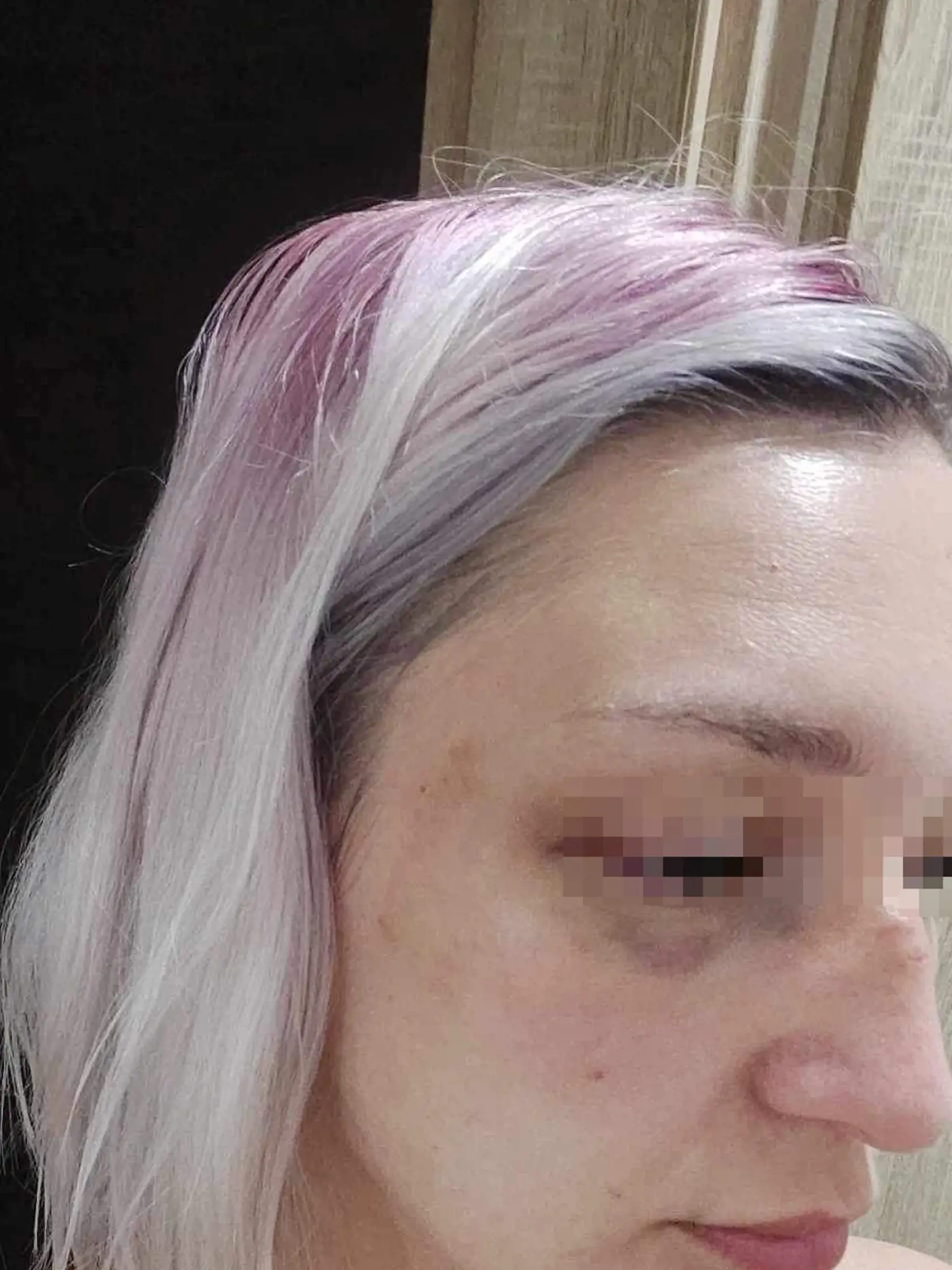 „Celý čas som sa s ním snažila rozprávať pokojne, aby som ho nijako nevyprovokovala,“ dodala žena.