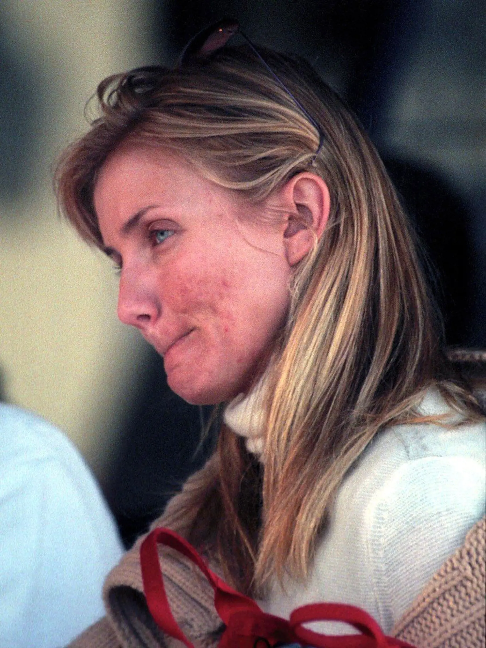 #7803803 Actress Cameron Diaz turns 39 years old on August 30, 2011 and here is a look back at her transformation from the girl next door to A-list celebrity.  Archived Images: #51171 EXCLUSIVE... Cameron Diaz has lunch in West Hollywood, California on December 12, 2001 with no makeup and has acne all over her face., Image: 101750380, License: Rights-managed, Restrictions: , Model Release: no, Credit line: Profimedia, Famepictures