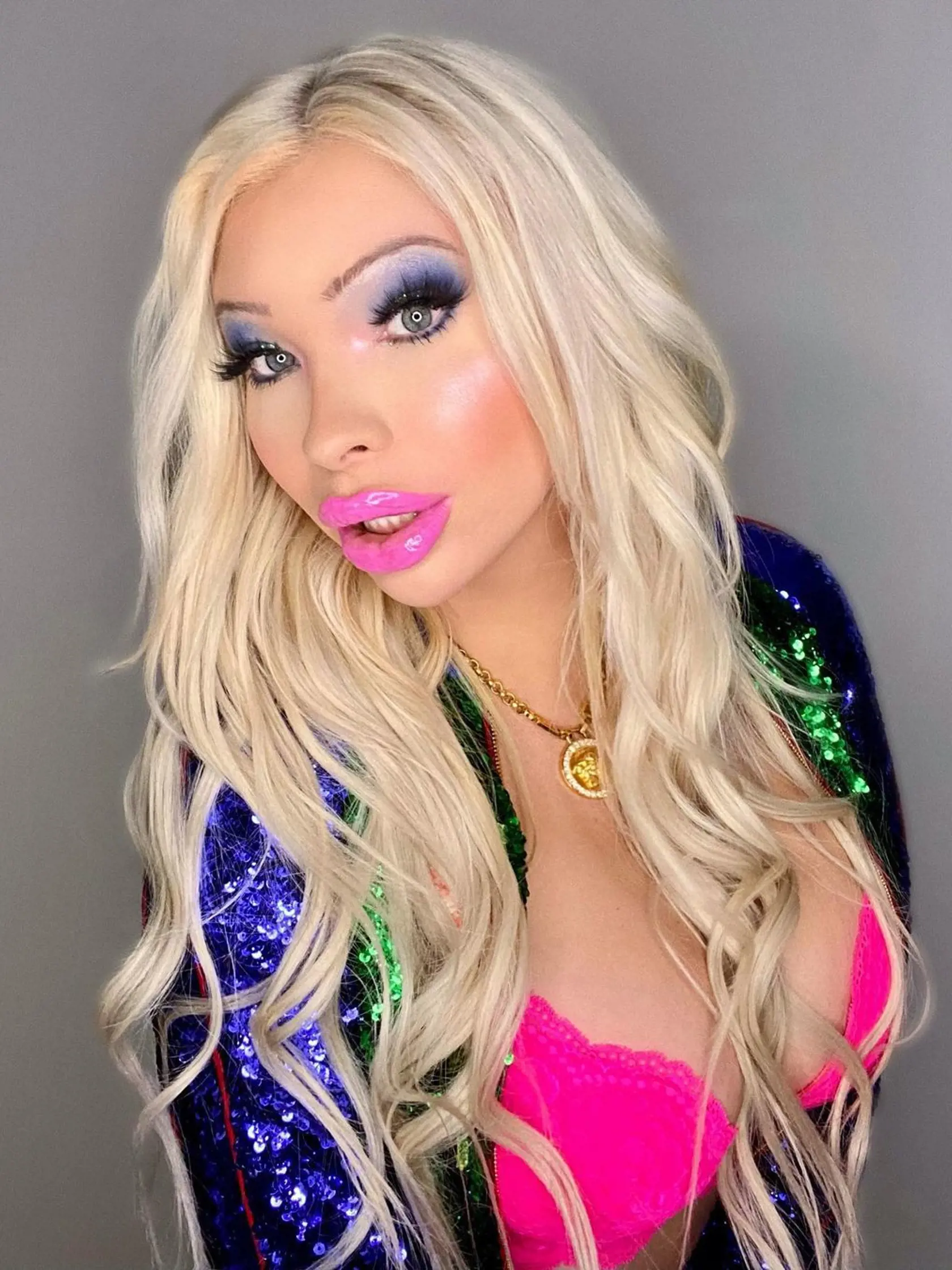 Serena Smith z Beverley Hills v Kalifornii má len 23 rokov, no za sebou už má početné množstvo plastických operácií. Jej snom bolo podobať sa idolom z éry zlatého Hollywoodu akými bola Marilyn Monroe či Jayne Mansfield. Na plastické operácie už minula bezmála 50-tisíc. S výsledkom však stále nie je spokojná.