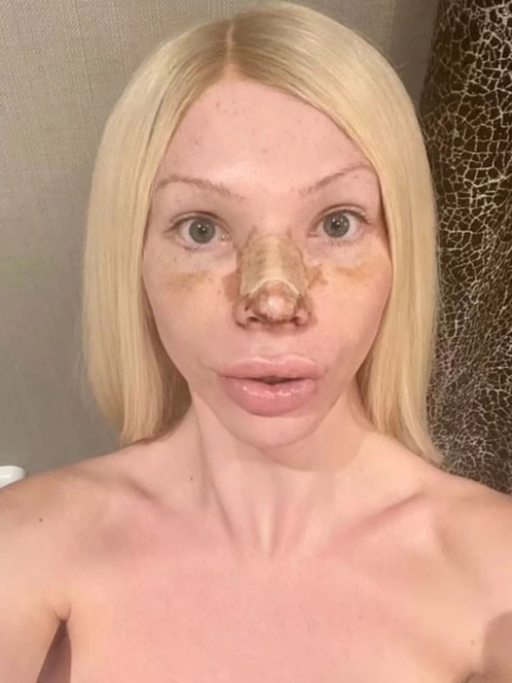 Serena minula za uplynulých šesť rokov neuveriteľných 49-tisíc dolárov na plastické operácie, aby sa svojim vzhľadom priblížila ikonickým kráskam Marilyn Monroe a Jayne Mansfield. Za 7500 dolárov si nechala zväčšiť prsia, 11-tisíc dolárov minula na plastiku nosa, 15-tisíc ju stáli výplne a naposledy minula 15 000 dolárov na brazílsku operáciu zdvihnutia zadku. Prvú operáciu podstúpila ešte v decembri v roku 2016, počas ktorej si nechala zväčšiť prsia.