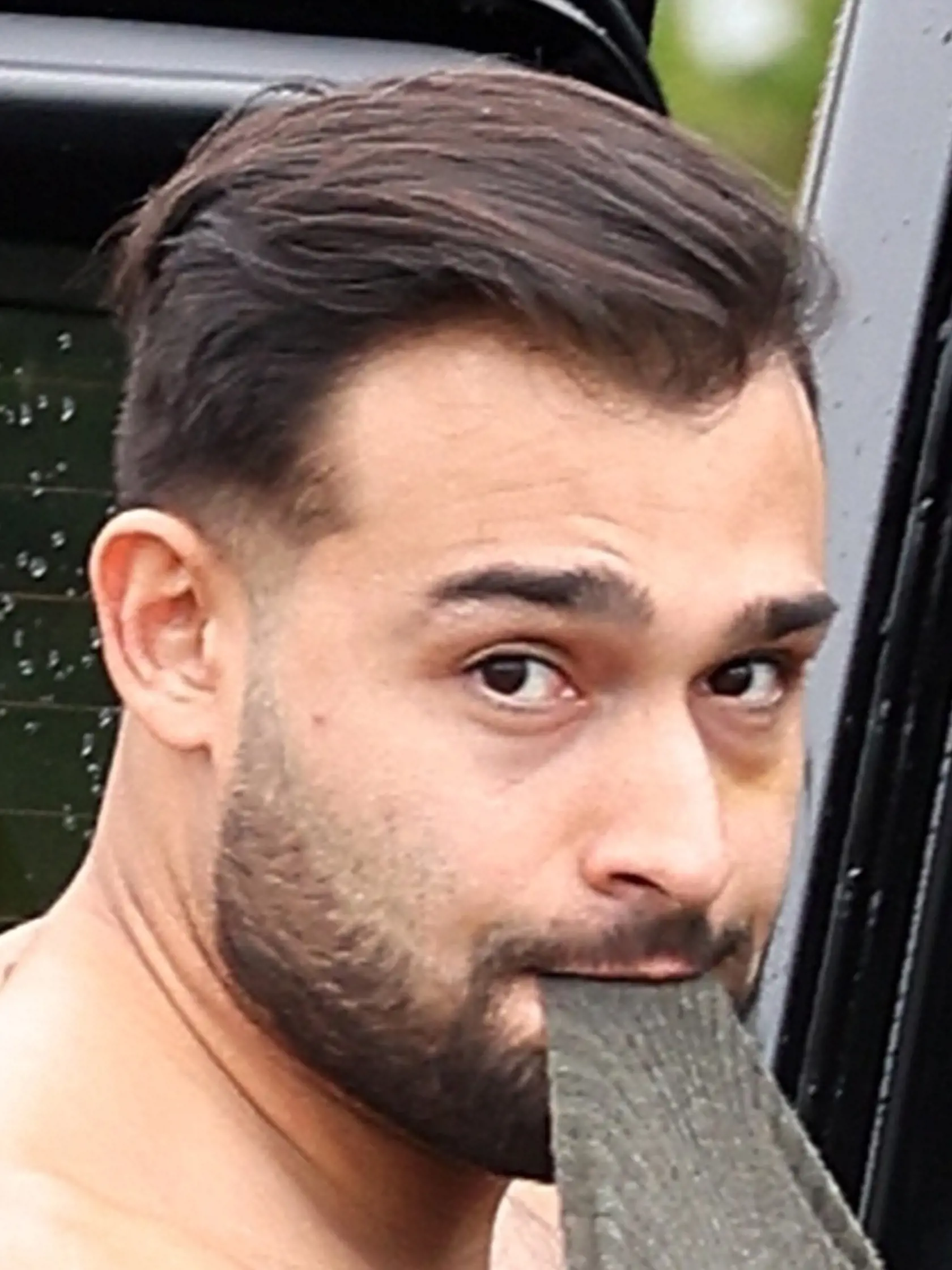 S monoklom: Britney vraj Sama napadla v spánku a spôsobila mu podliatiny, čomu majú nasvedčovať tieto fotky z januára. Vraj pri viacerých ich hádkach musela zasahovať ochranka.