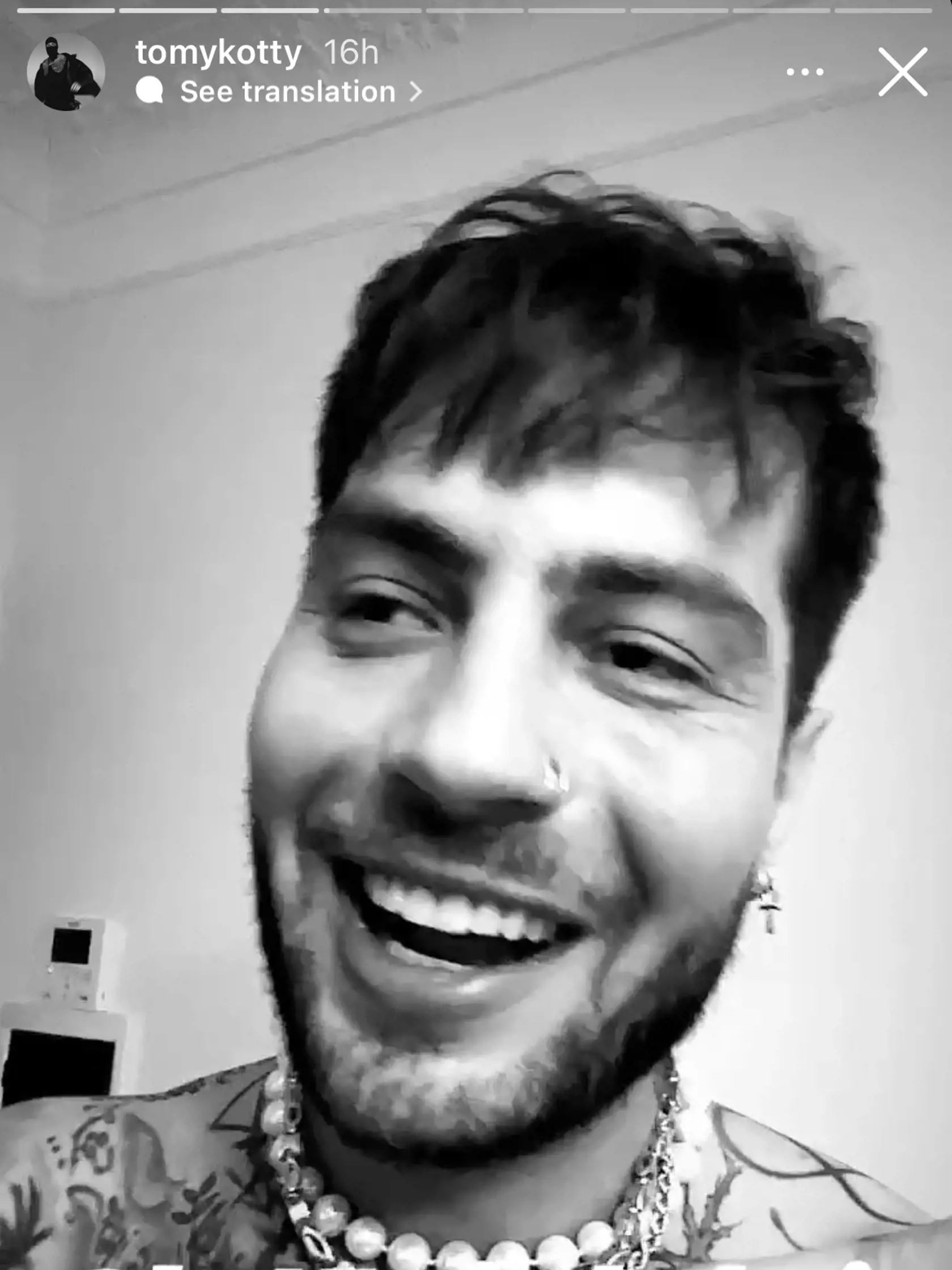 Tomy Kotty (30) reaguje na obvinenia z krádeže pesničky.