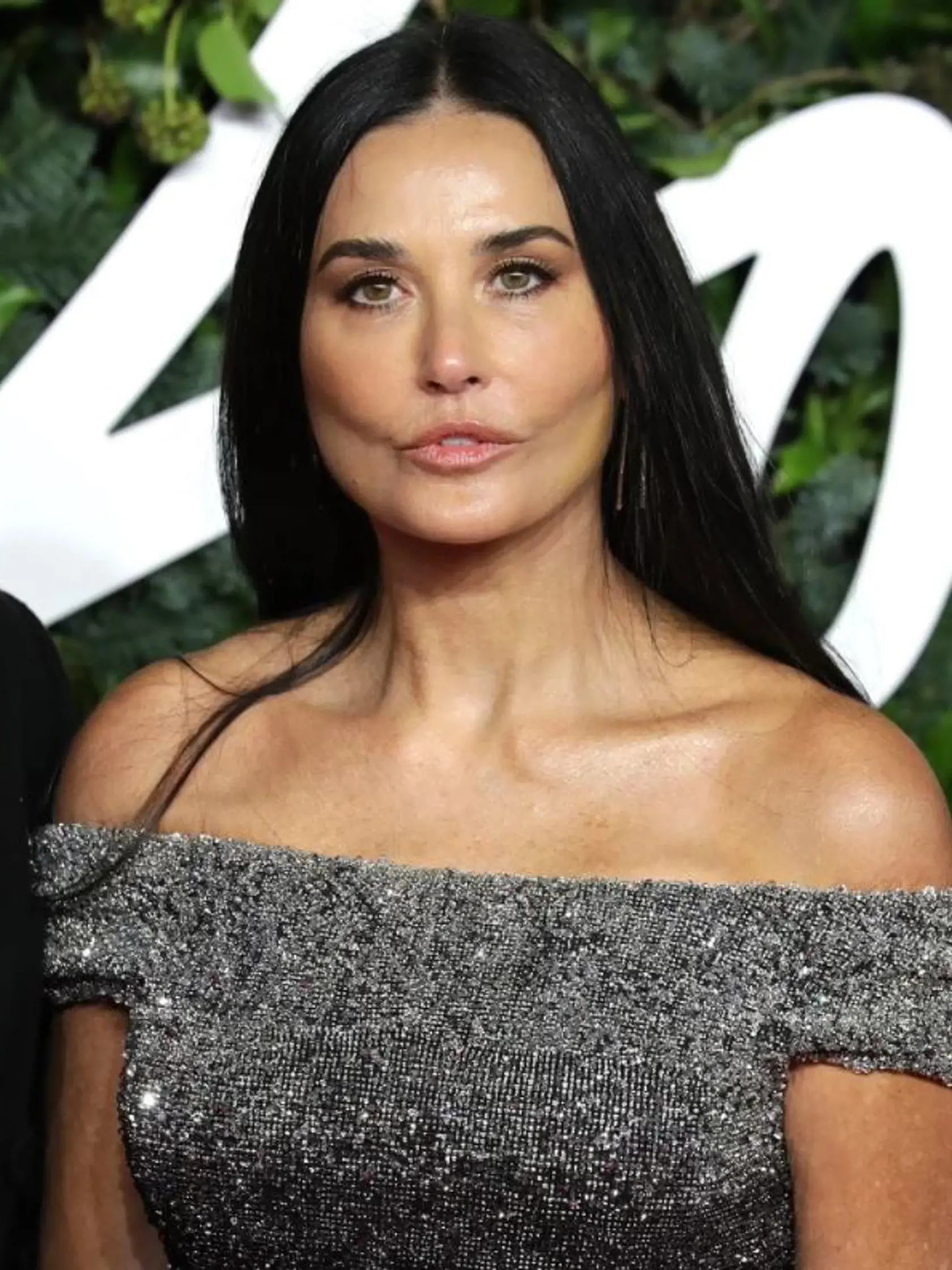 Demi Moore po zrejme nevydarenom liftingu tváre.