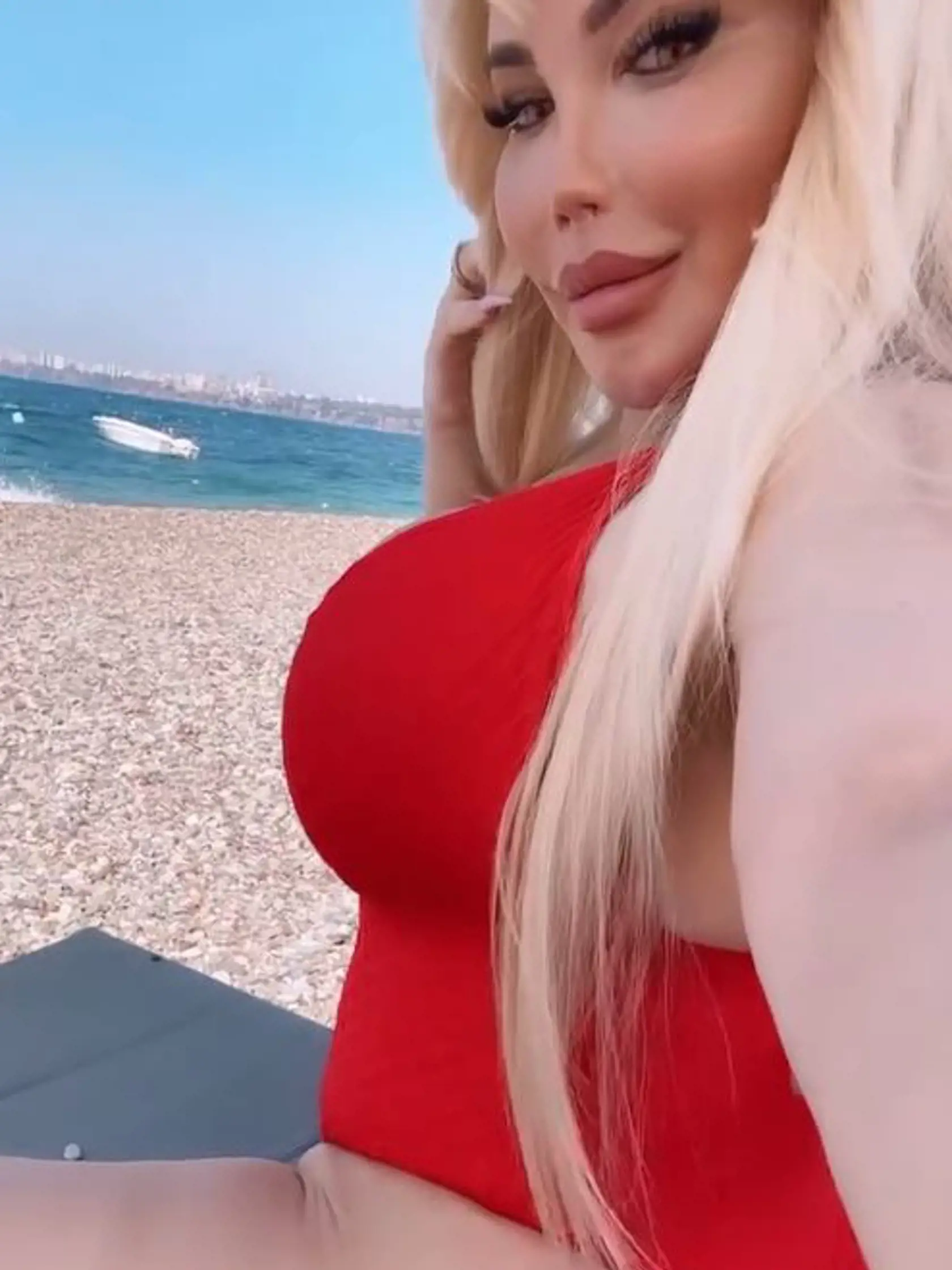 Jessica sa po zákroku aktuálne zotavuje v zariadení v Antalyi a stráca a podľa jej slov stráca jeden kilogram za deň pri konzumácii iba detoxikačných nápojov.