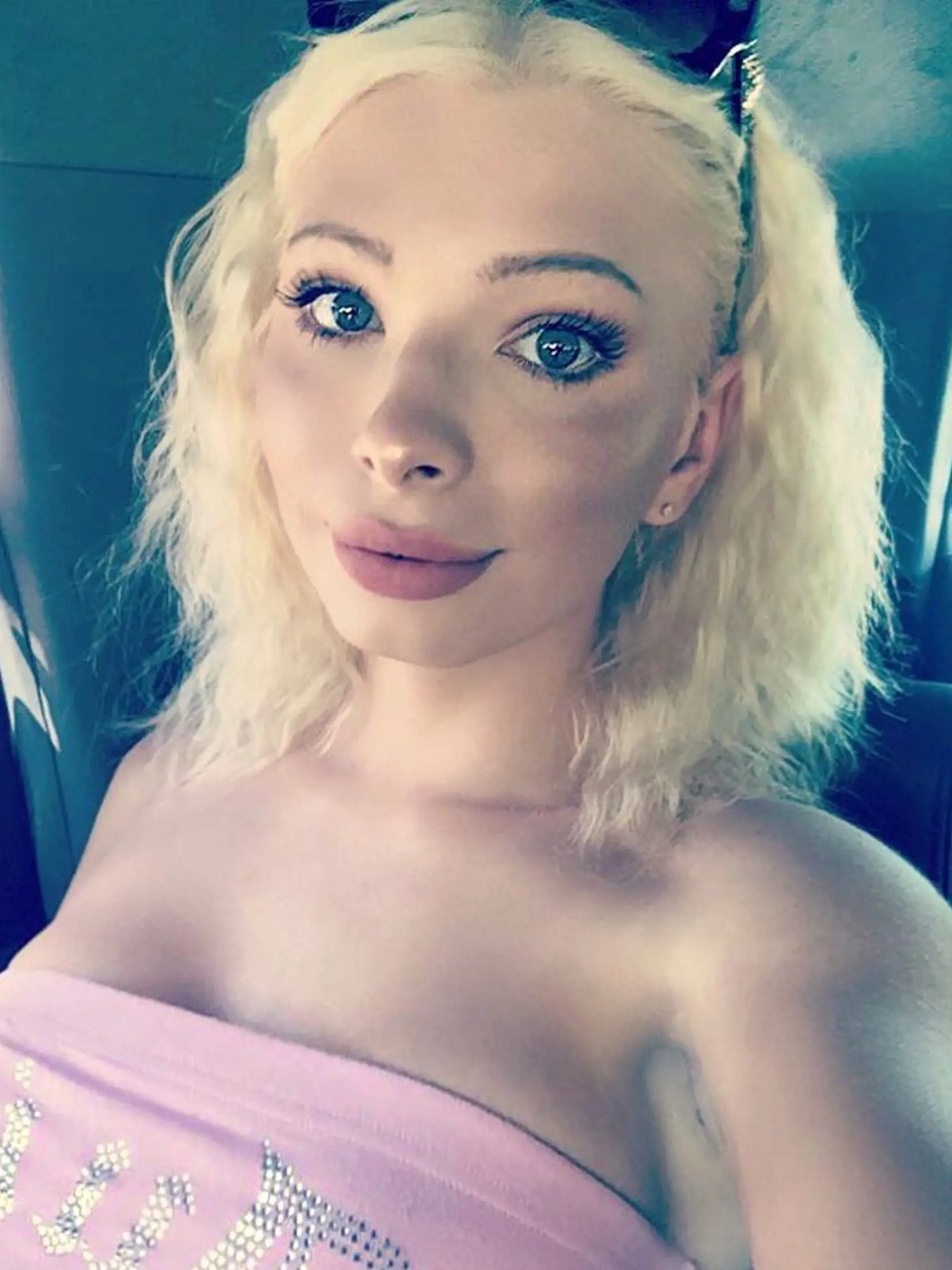 Má iba 23 rokov a množstvo plastických operácií: Chcela byť ako Marilyn Monroe, no je ako...Fú!