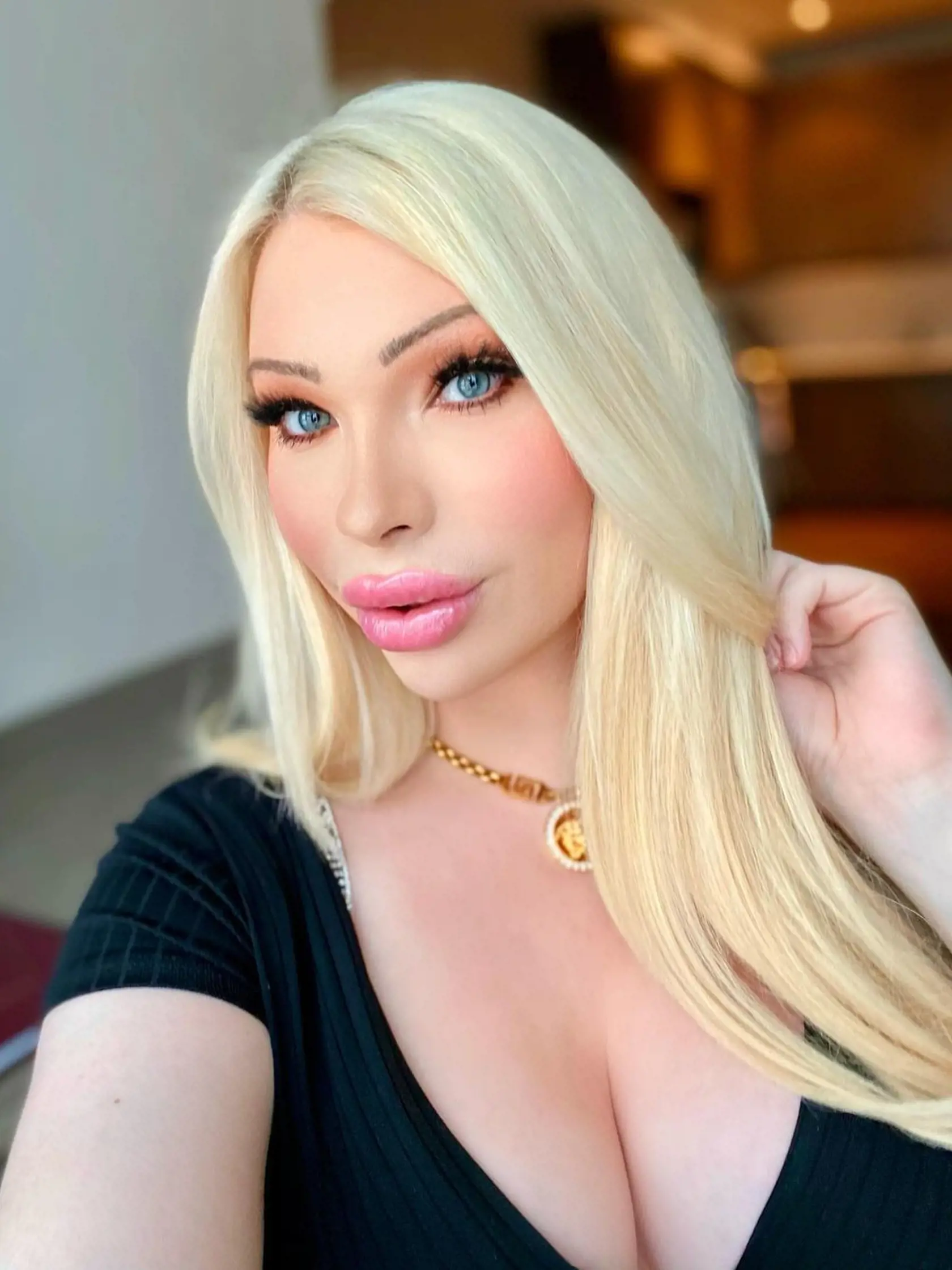 Má iba 23 rokov a množstvo plastických operácií: Chcela byť ako Marilyn Monroe, no je ako...Fú!