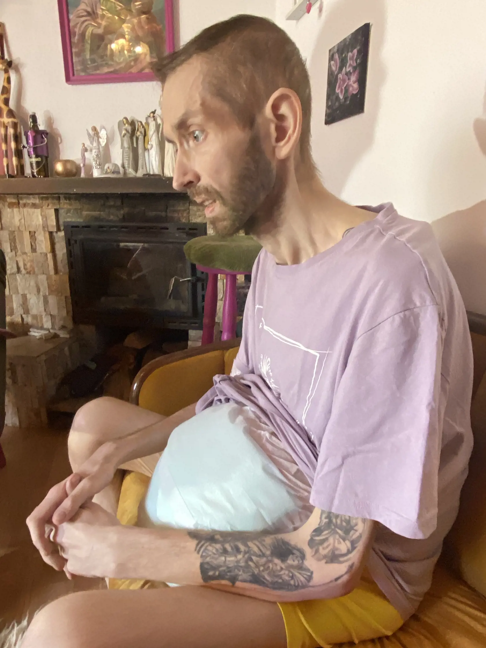 Lukáš. Zo statného chlapa bola pred mesiacom už iba kostra, schudol 90 kíl.