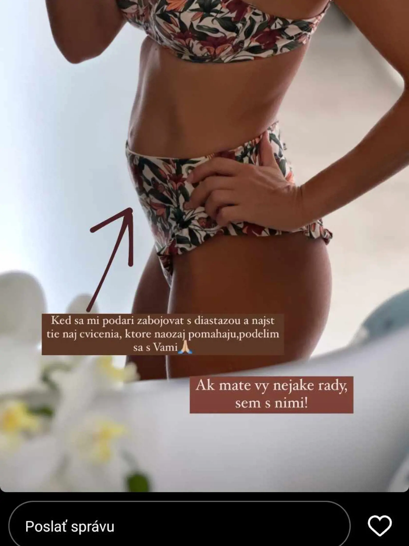 Pôrody sa podpísali pod tvar jej bruška. Teraz ho Ivana ukázala zblízka.