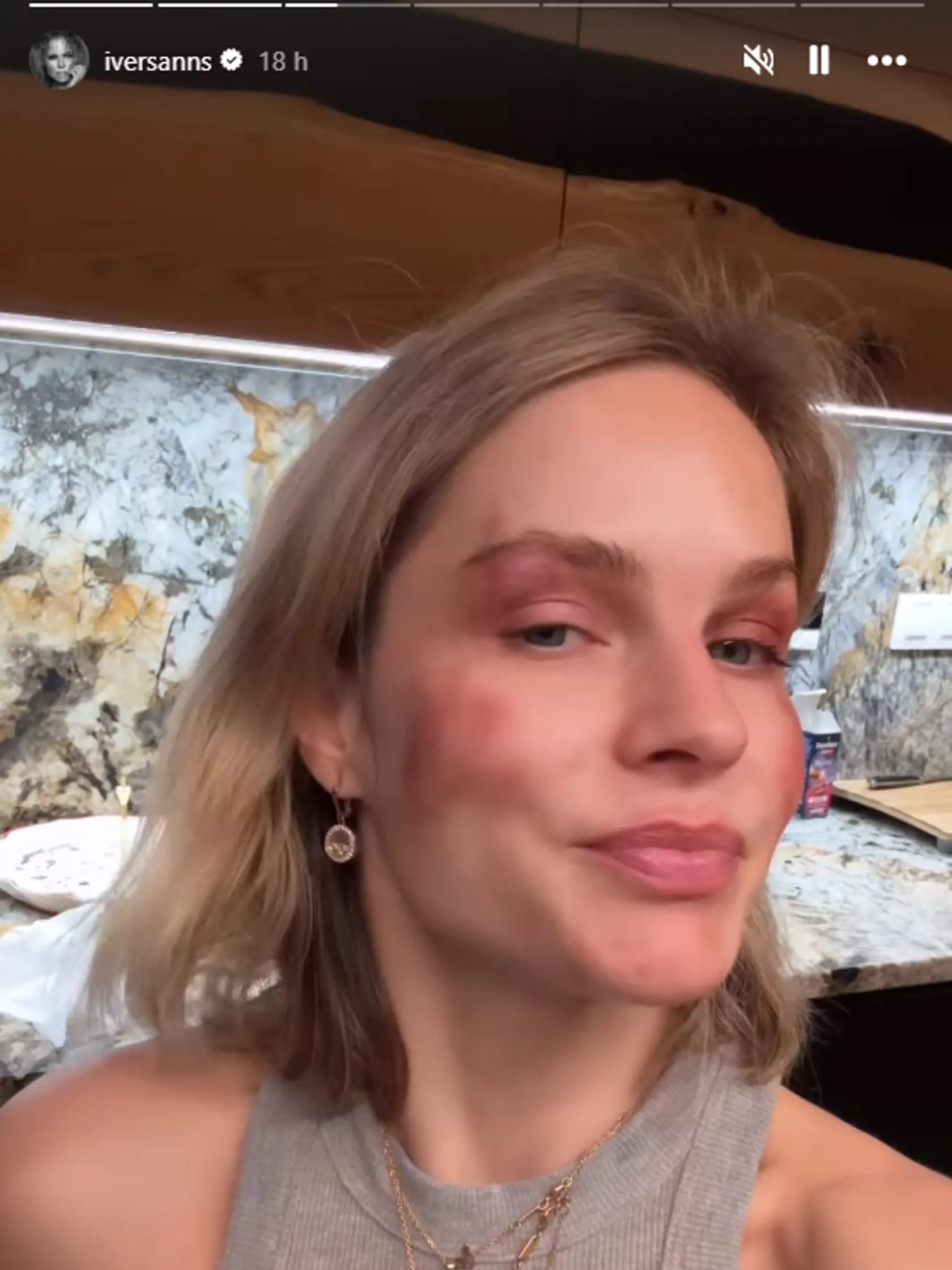 Ivana Gáborík ukázala, ako ju zmaľovala jej dcérka Bella. 