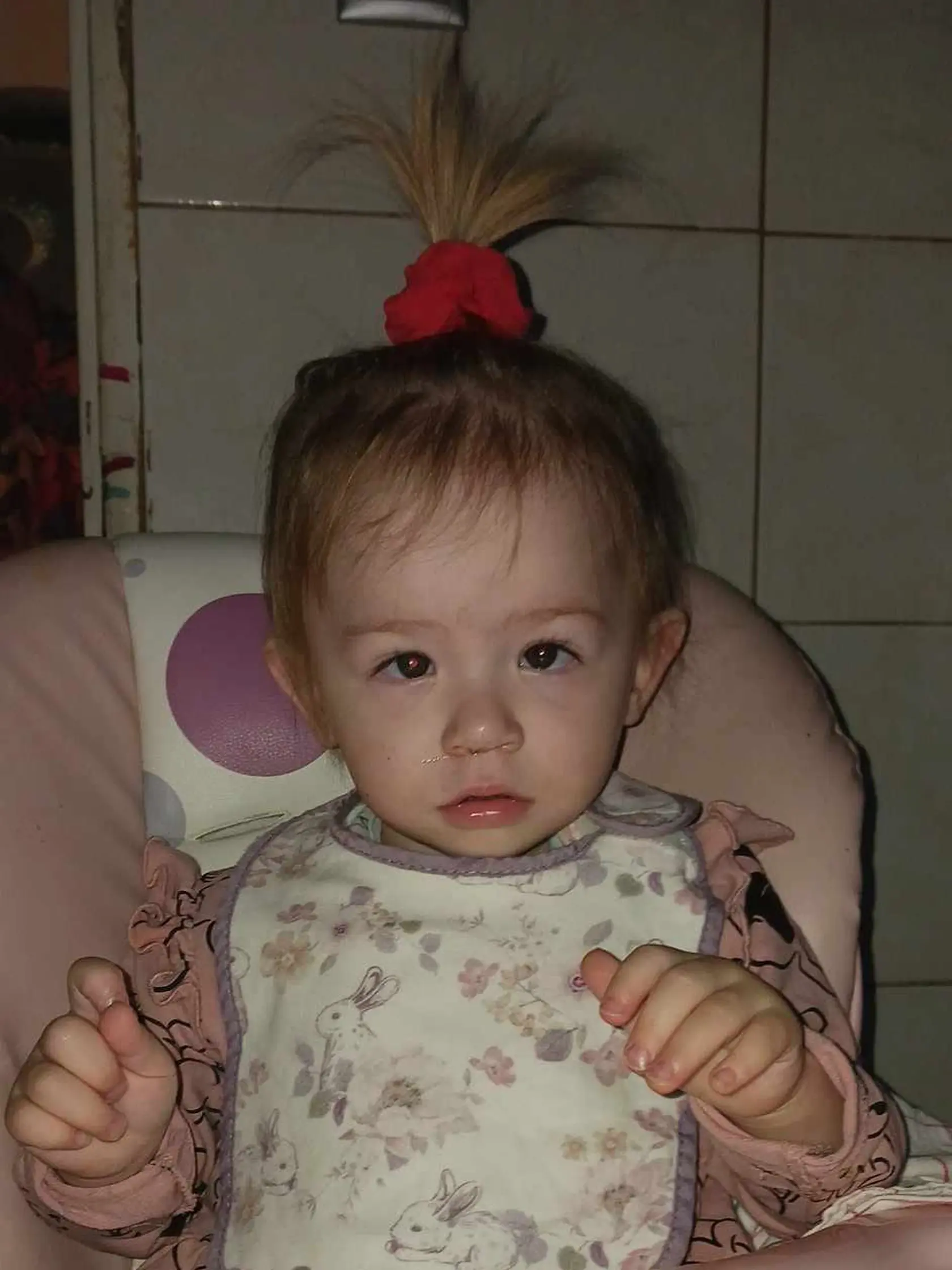 Nanešťastie sa prejavili všetky predpokladané vady - defekt predsiene srdca, pneumónia a vyskytli sa aj problémy so zrakom kvôli tomu, že sa narodila v ôsmom mesiaci.