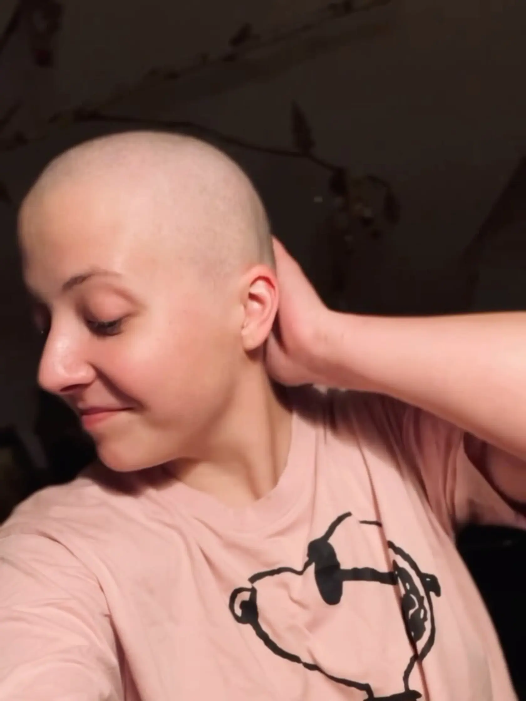 Anička Slováčková opäť prišla o vlasy.