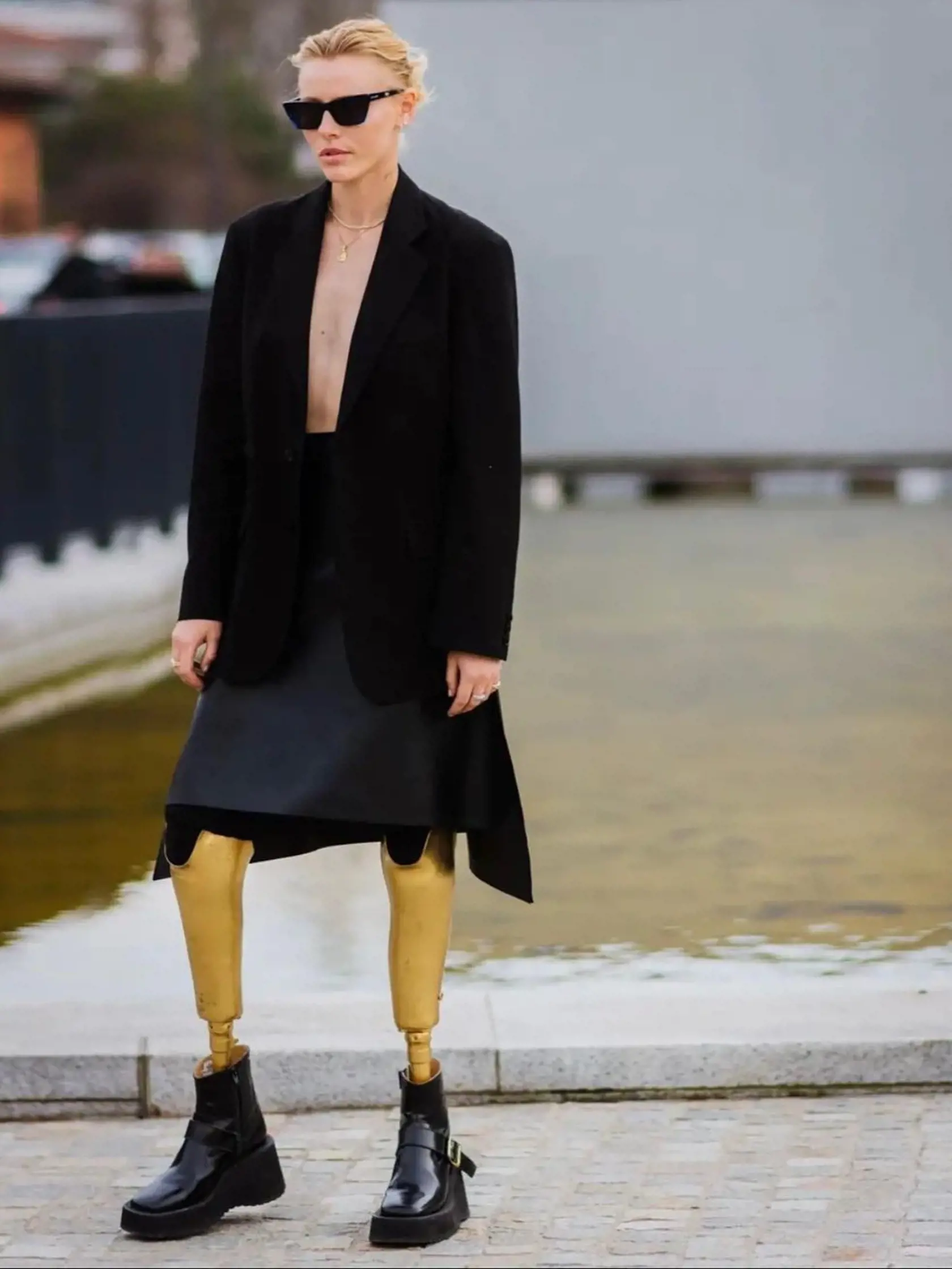 Lauren prišla o nohy kvôli syndrómu toxického šoku. Napriek tomu sa presadila v modelingu.