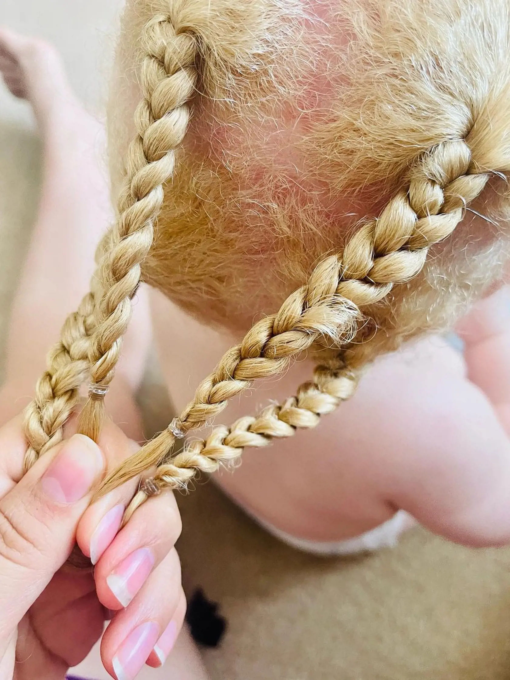 Dievčatko sa narodilo s bledou pokožkou a blond vlasmi.