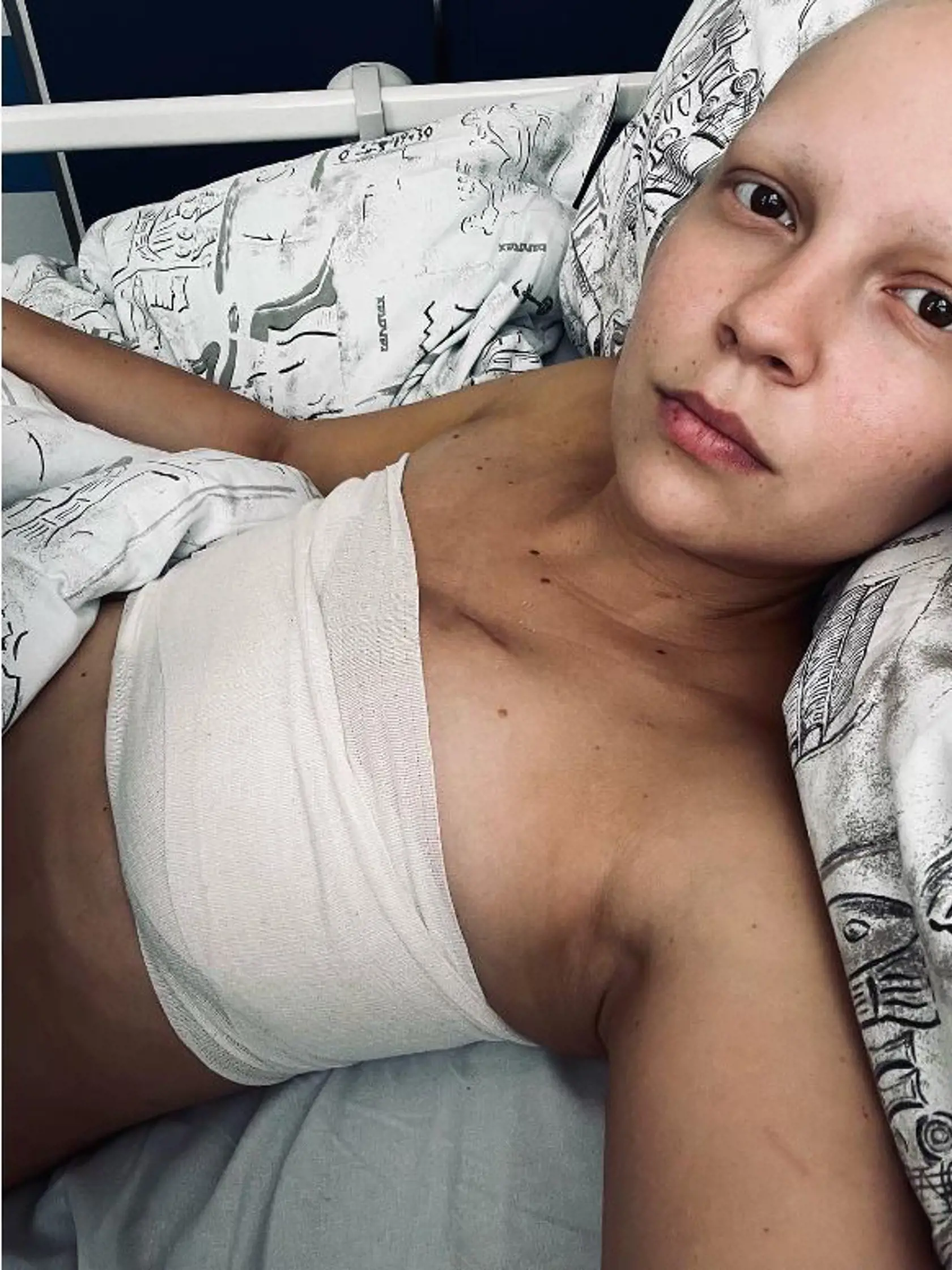 Patrícia Janečková podstúpila mastektómiu.
