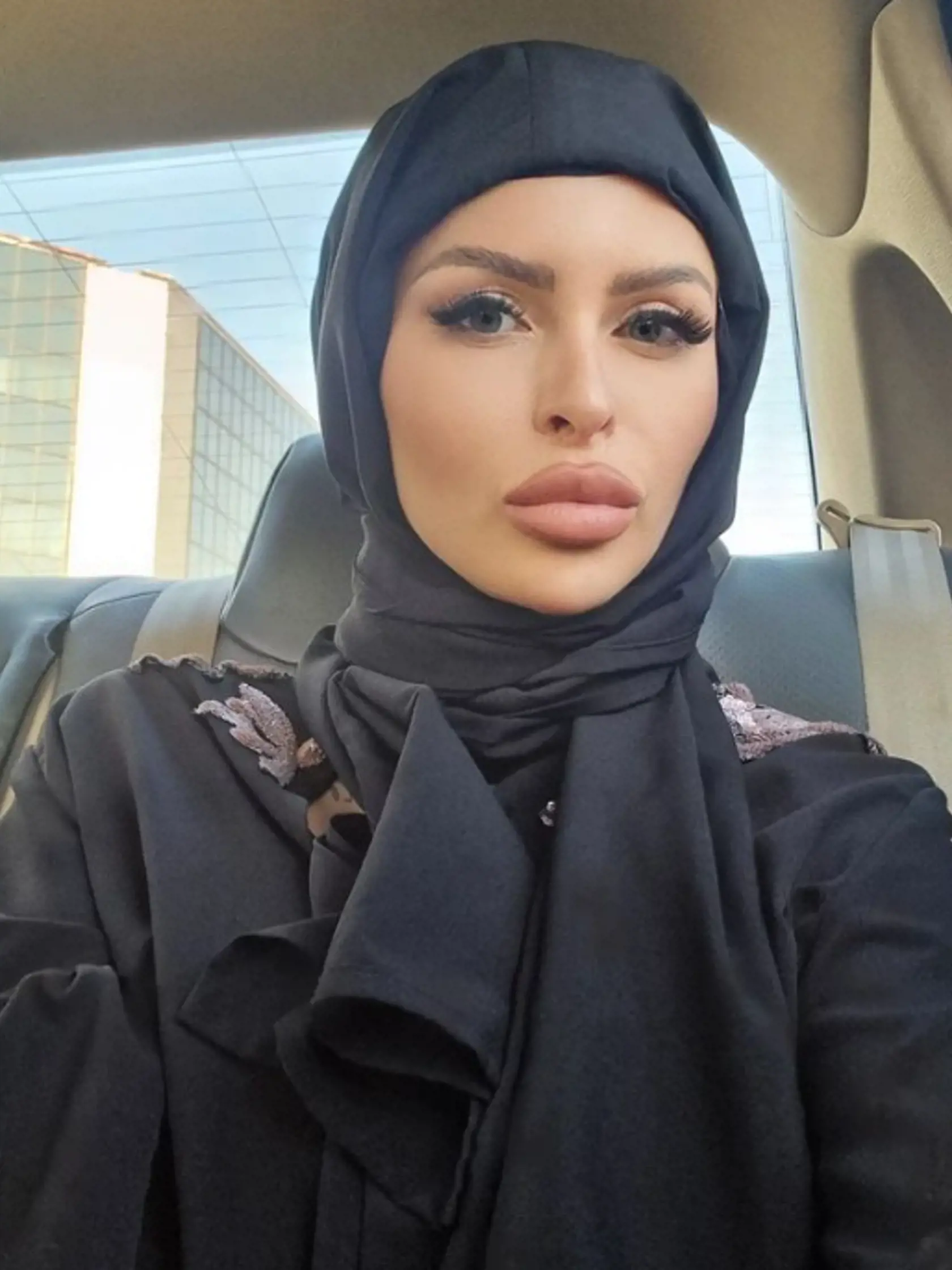 Lela Ceterová podstúpila 2 plastiky tváre v Iráne.