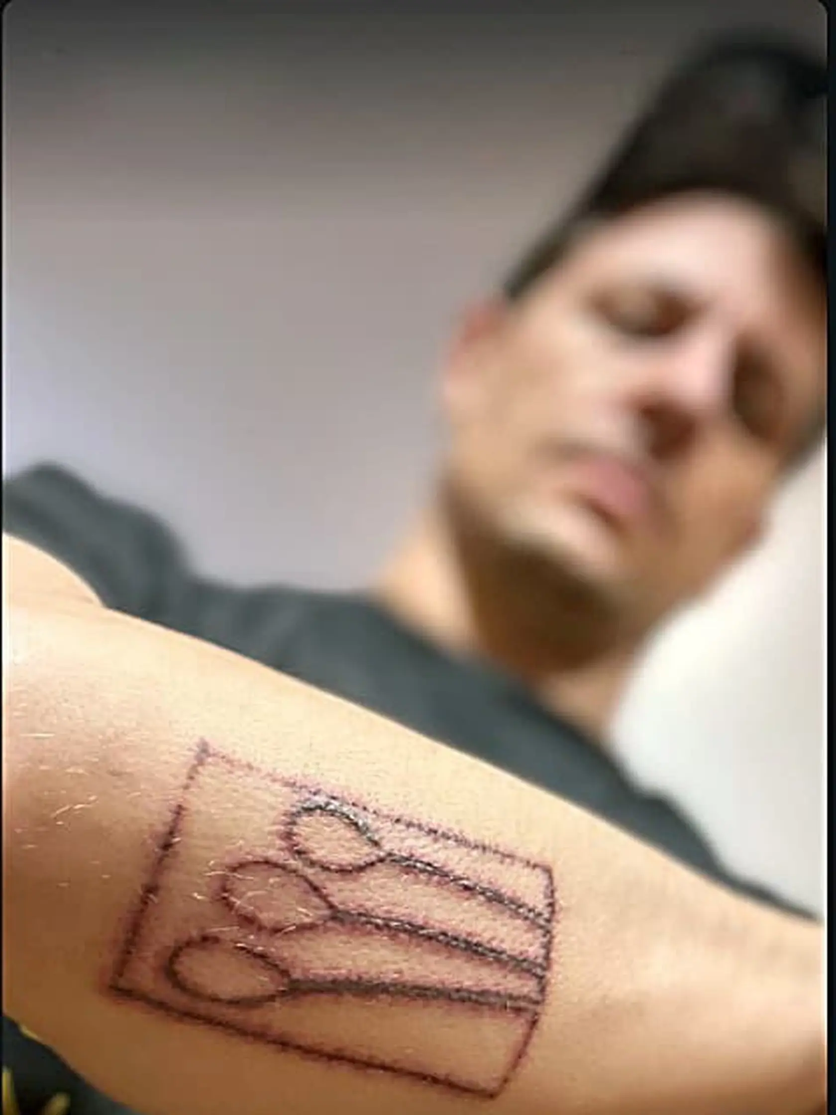 Juraj Loj chce toto tetovanie nadobro odstrániť.