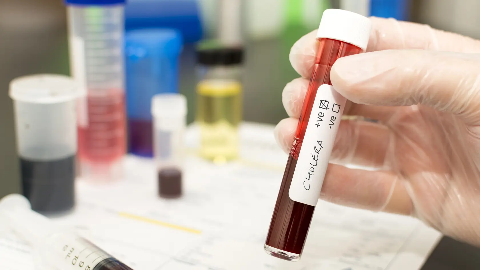 Najnovší prípad cholery je z Poľska, kde ju v meste Stargard diagnostikovali u staršej ženy.